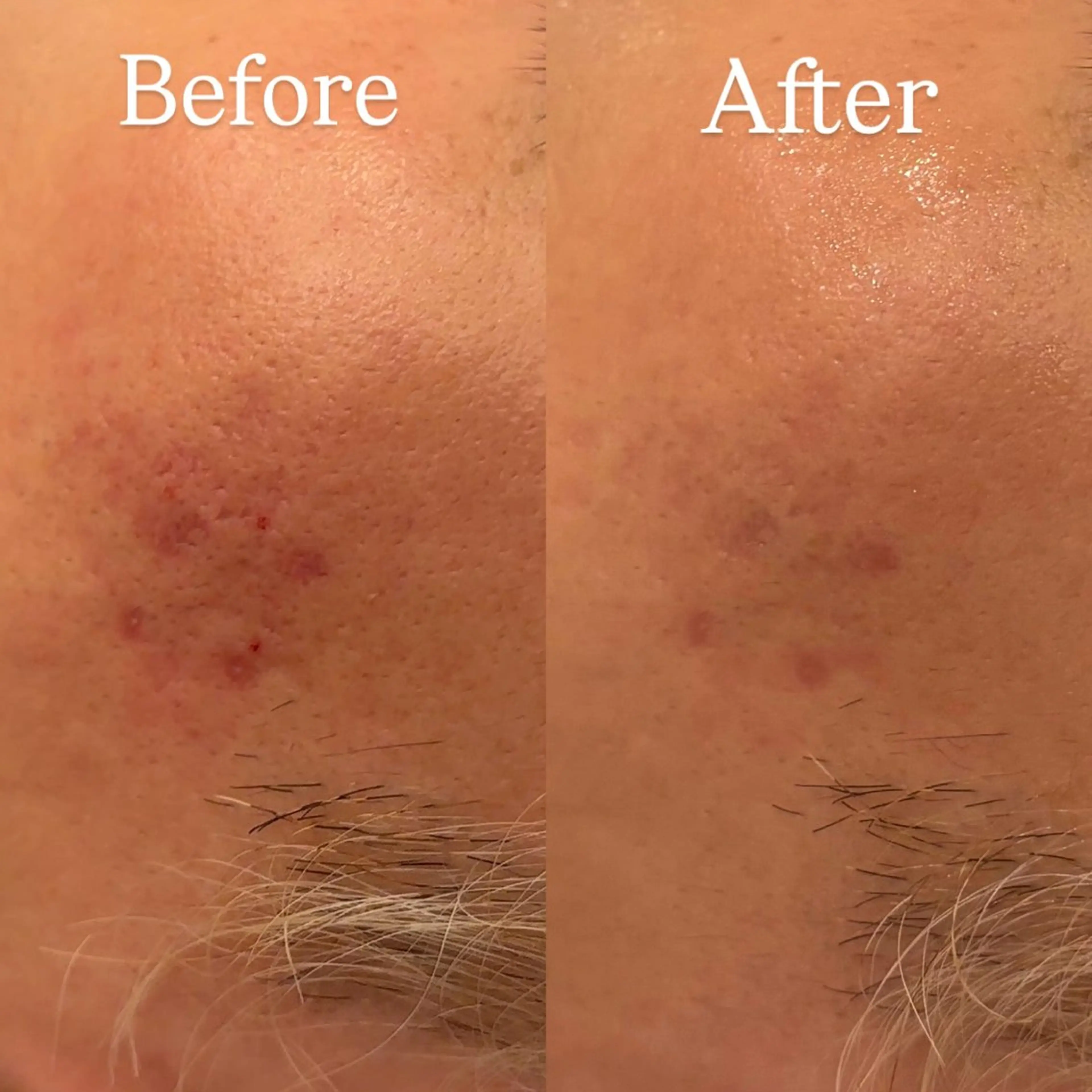 chika🦋 ハリラウンジ恵比寿のエステ・リラクイメージ