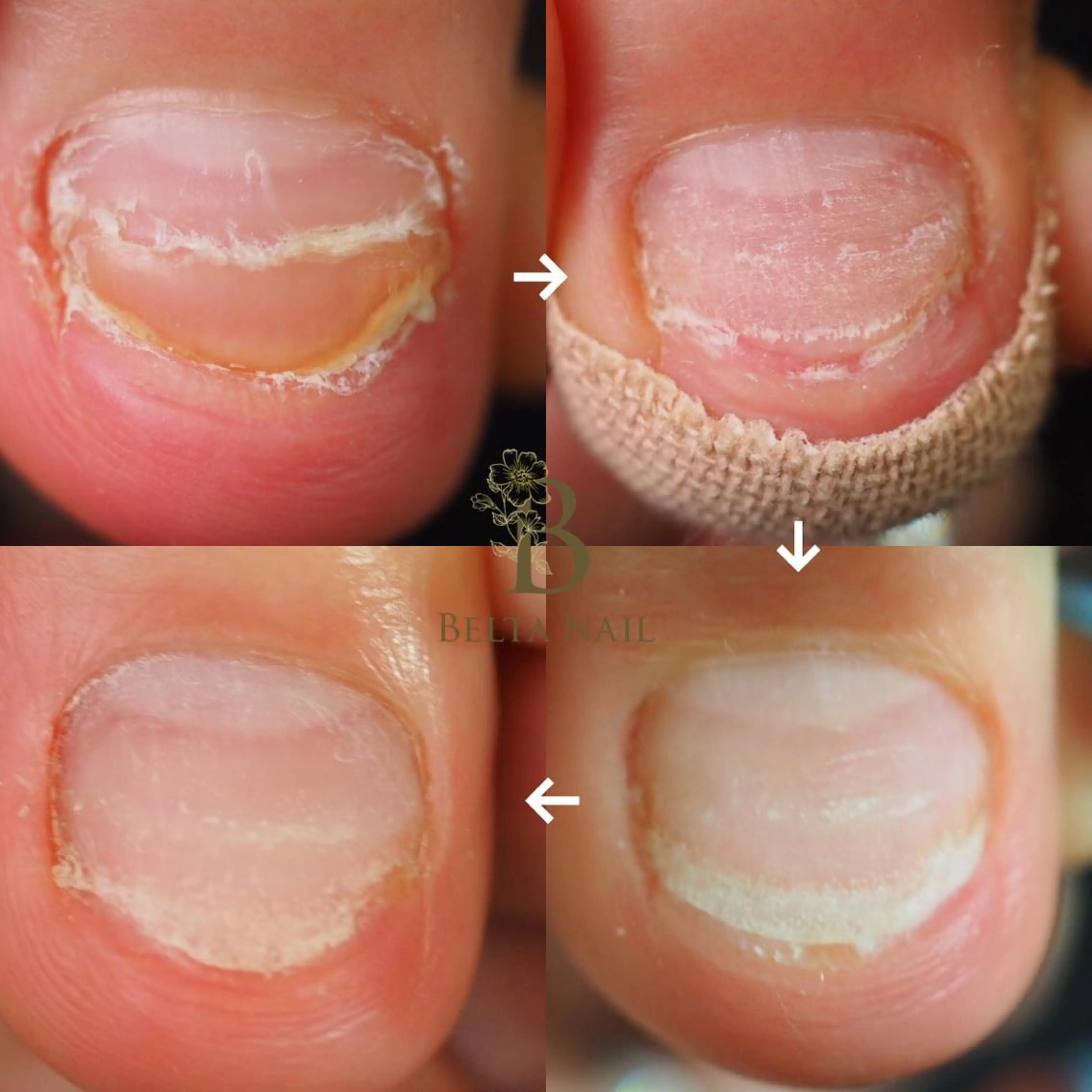 ネイル フットネイル BELTA NAILのネイルデザイン