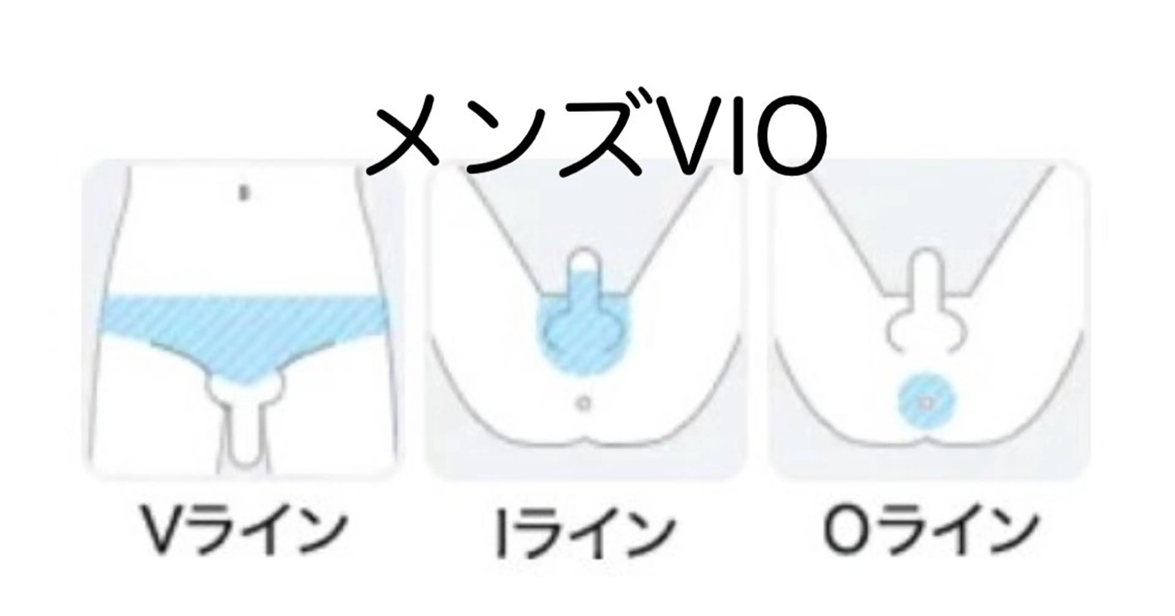 🥸メンズ脱毛【VIO】の写真