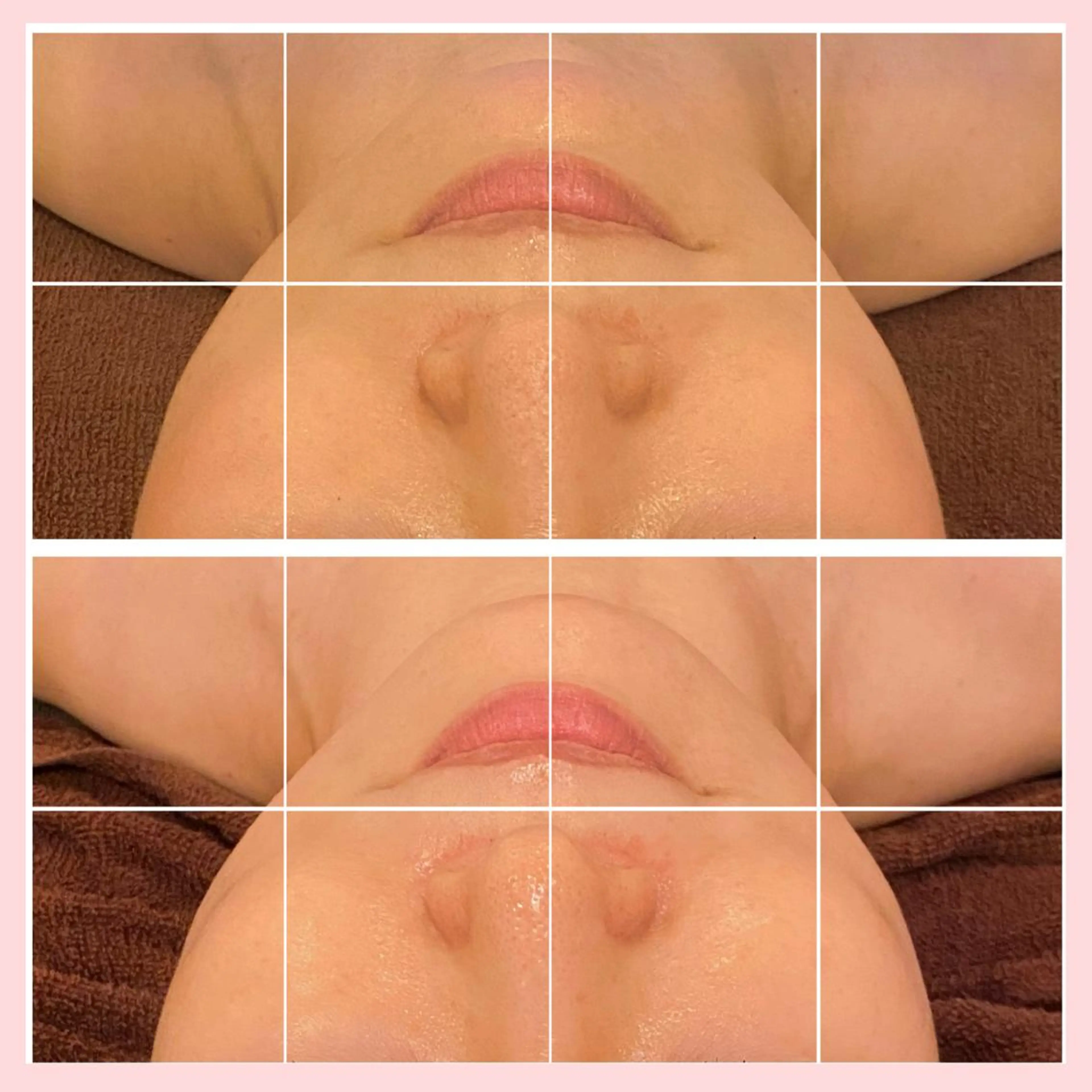 【コルギ&ハイパーナイフEX】小顔✕小顔🩷より小顔をキープできる‼️小顔コルギ矯正スペシャル✨の写真