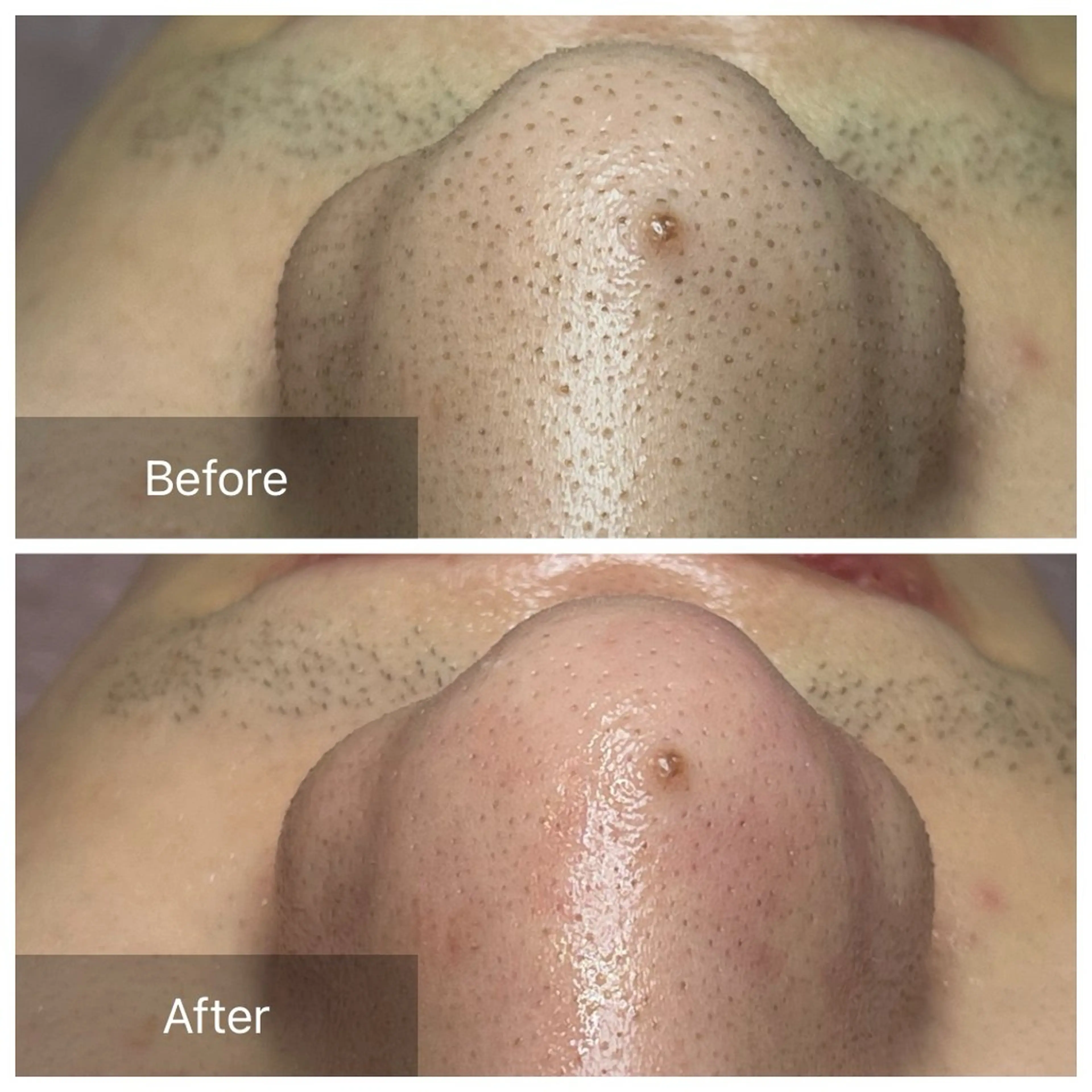 エステ ielu〜毛穴ケア ハーブピーリングのエステ・リラクイメージ