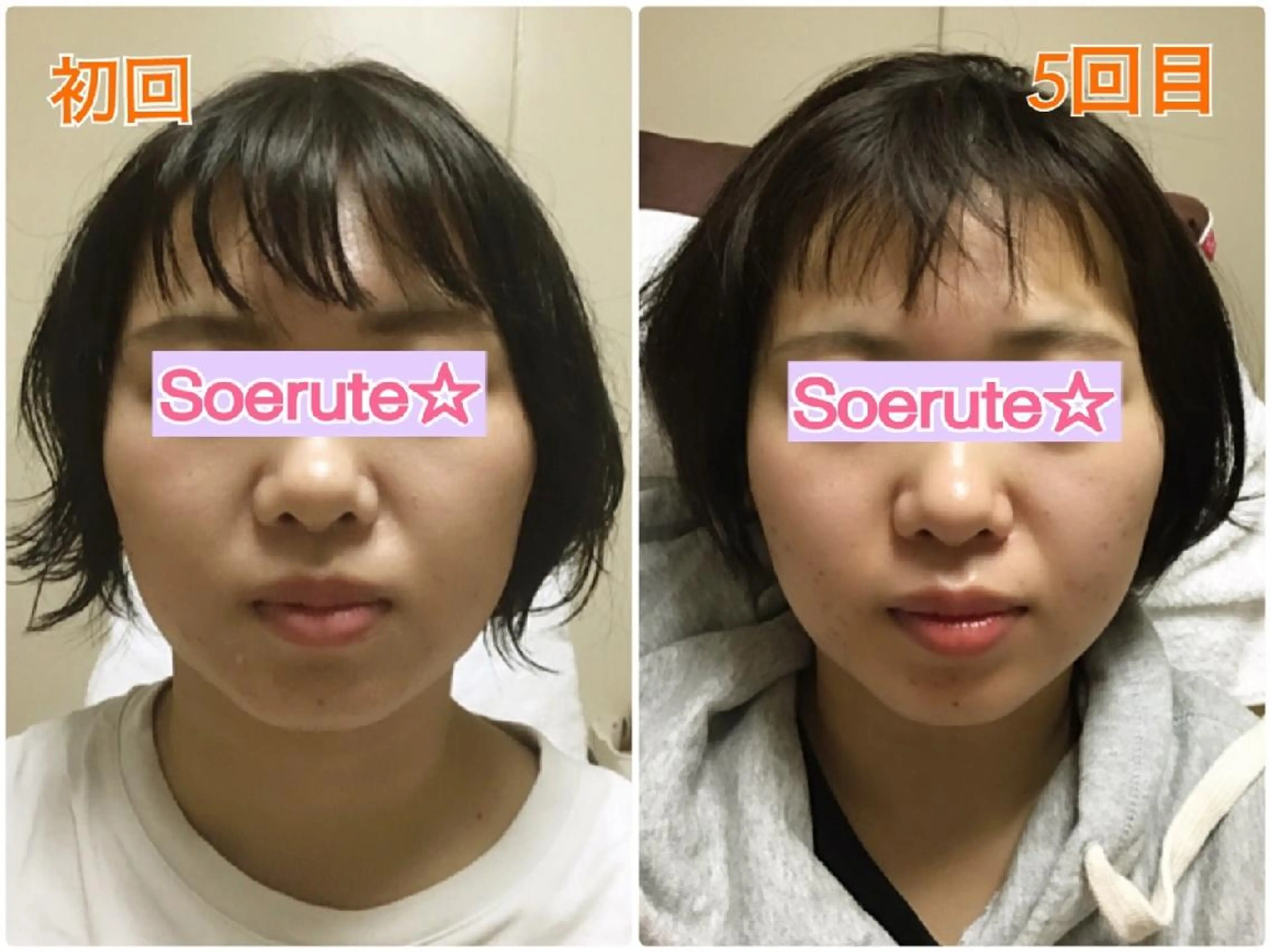 Soerute☆ ソエルテ 井上みえのエステ・リラクイメージ