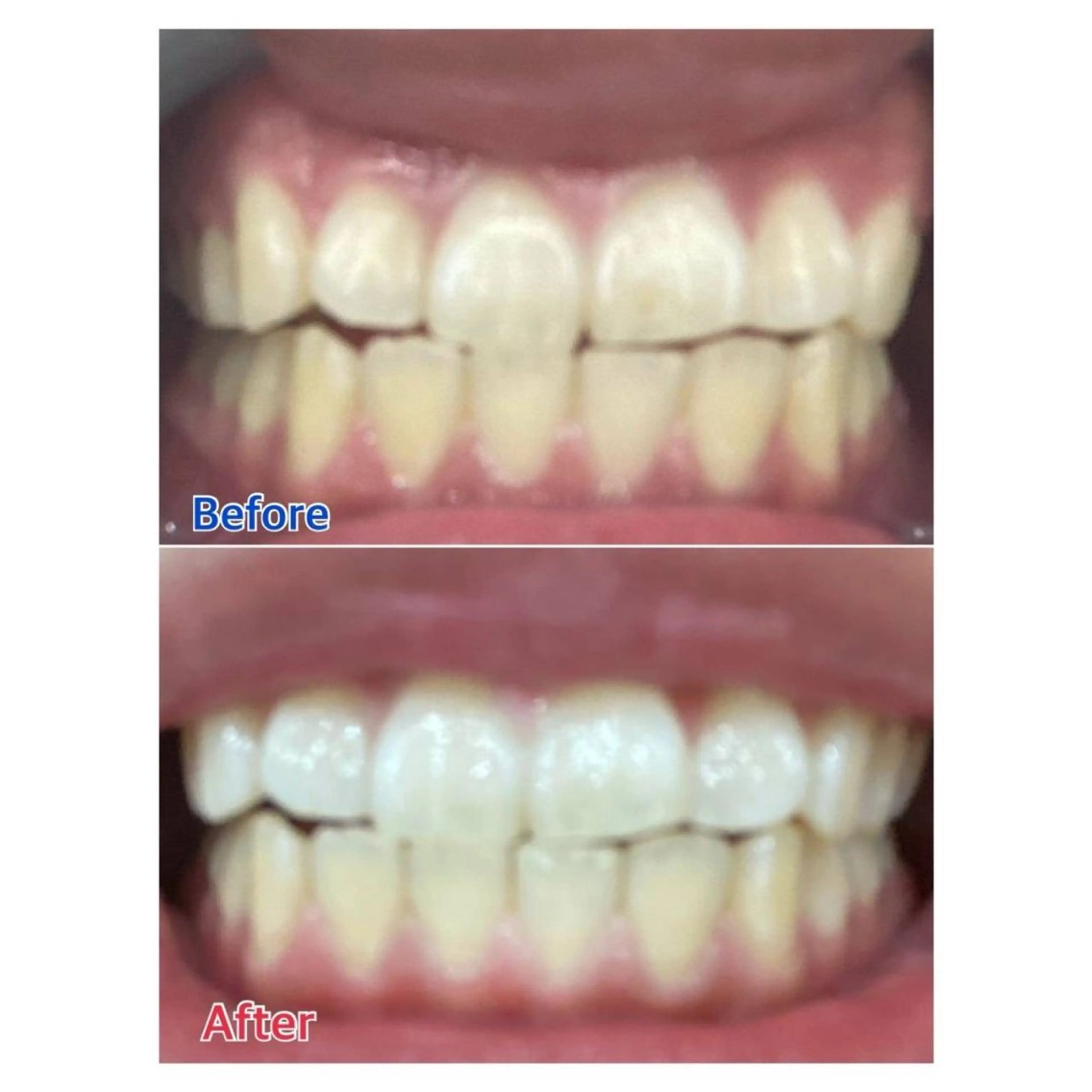 Melty 輝のその他イメージ