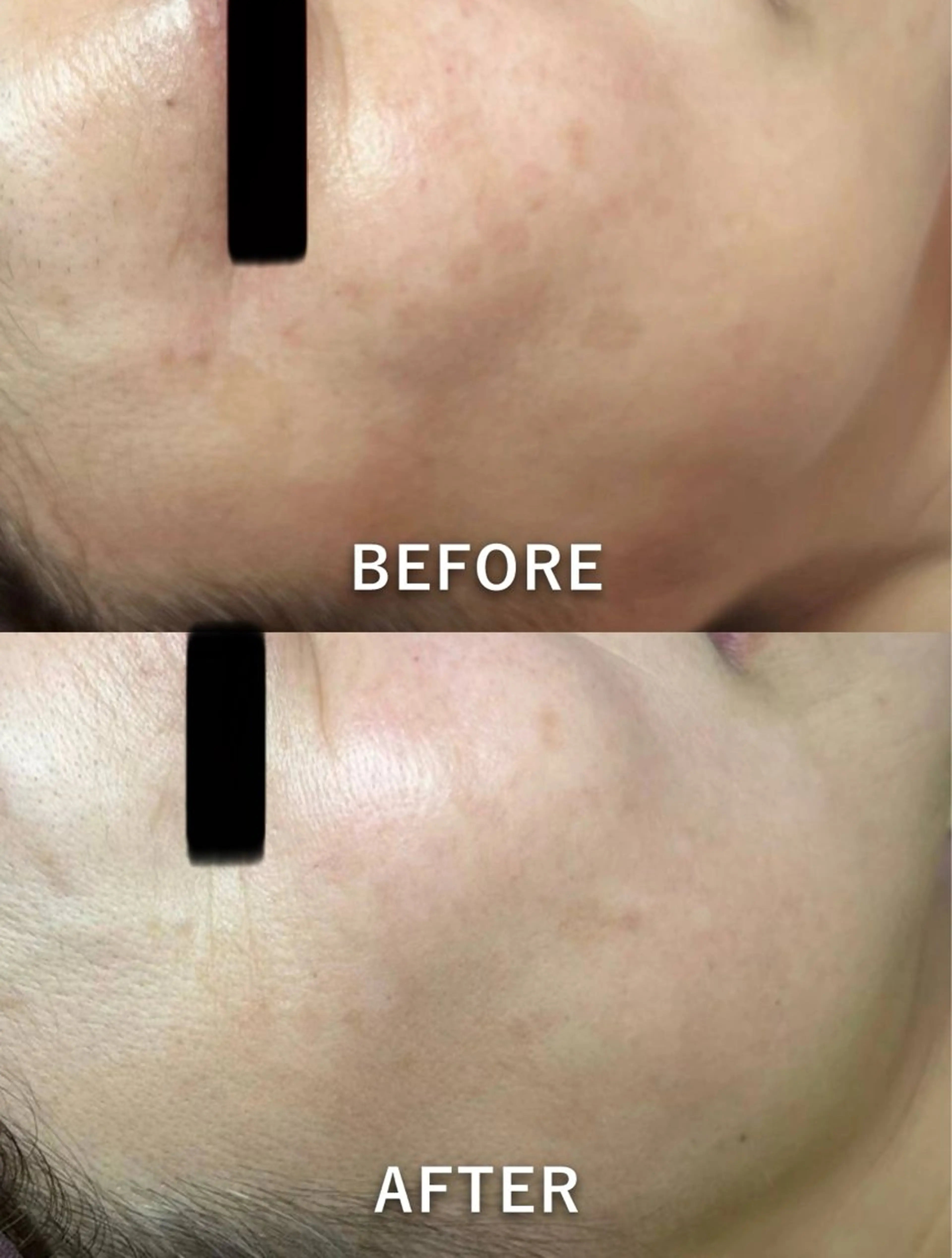 エステ 🌞シミケアサロン @SUNiko🌴のエステ・リラクイメージ