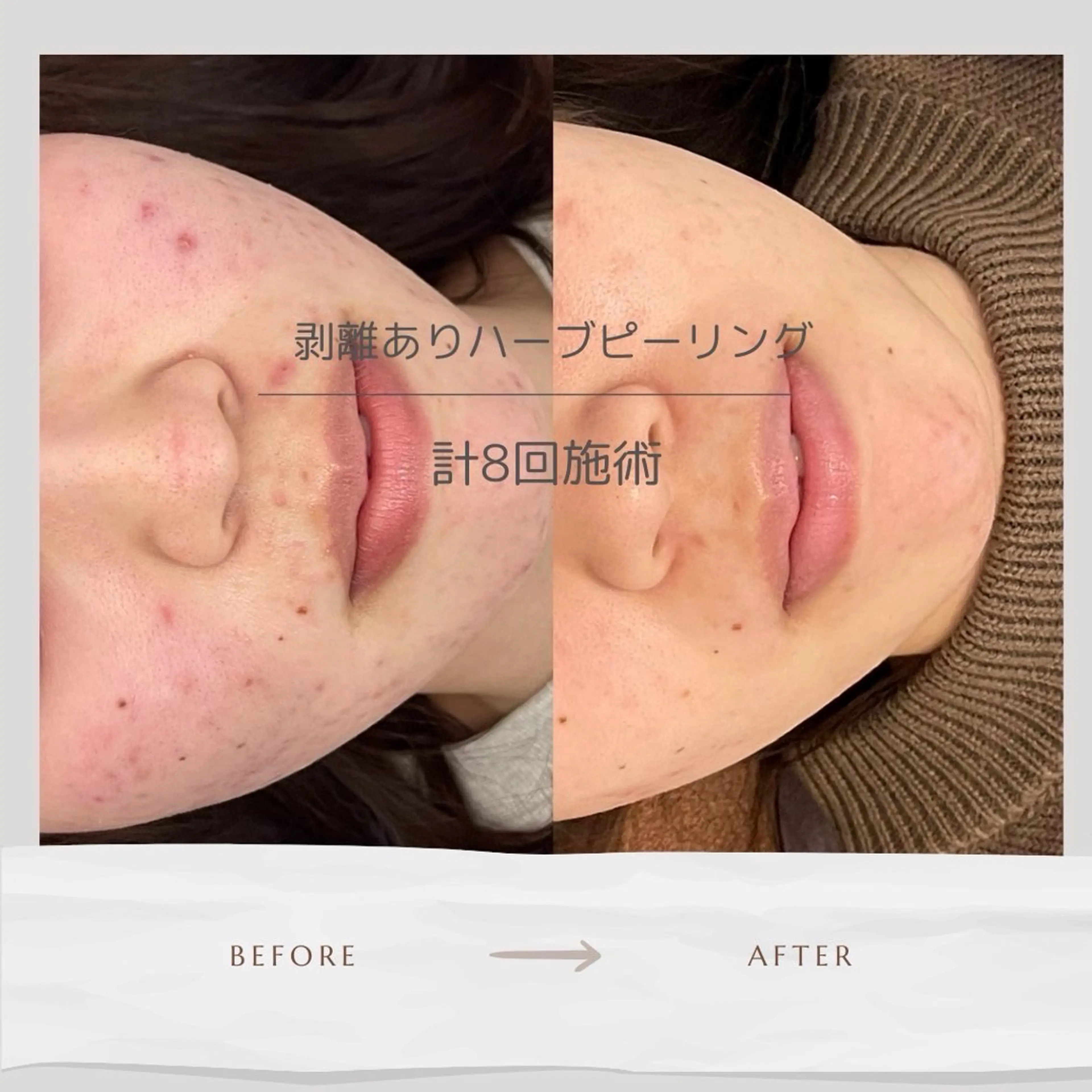 Life Salon別府店のエステ・リラクイメージ