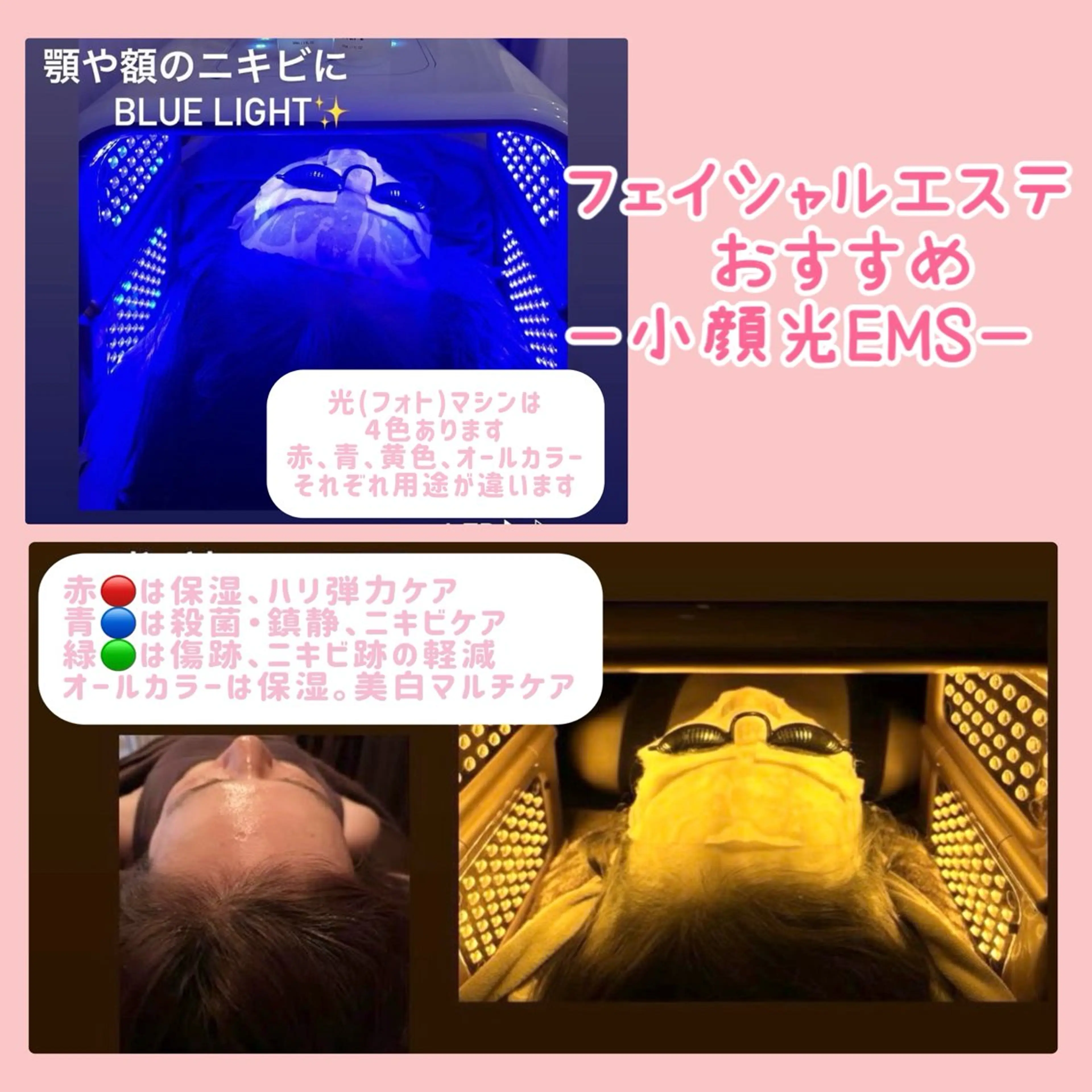 【毛穴掃除+小顔リフト】フォトEMS使用、二重顎、頬、目元の緩みを改善◎ハリ、弾力UP♥️毛穴も綺麗にの写真