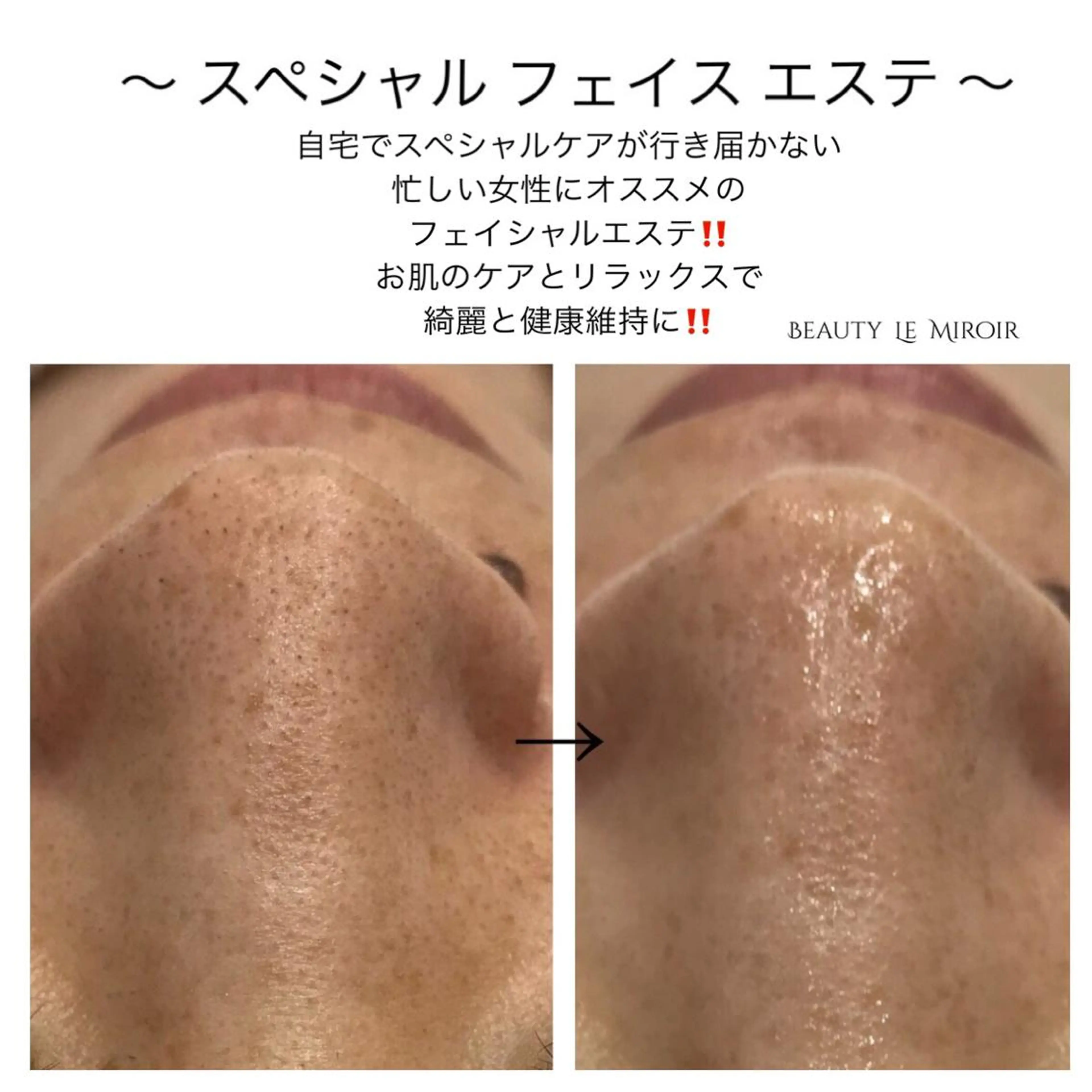 ビューティー ミロワールのエステ・リラクイメージ