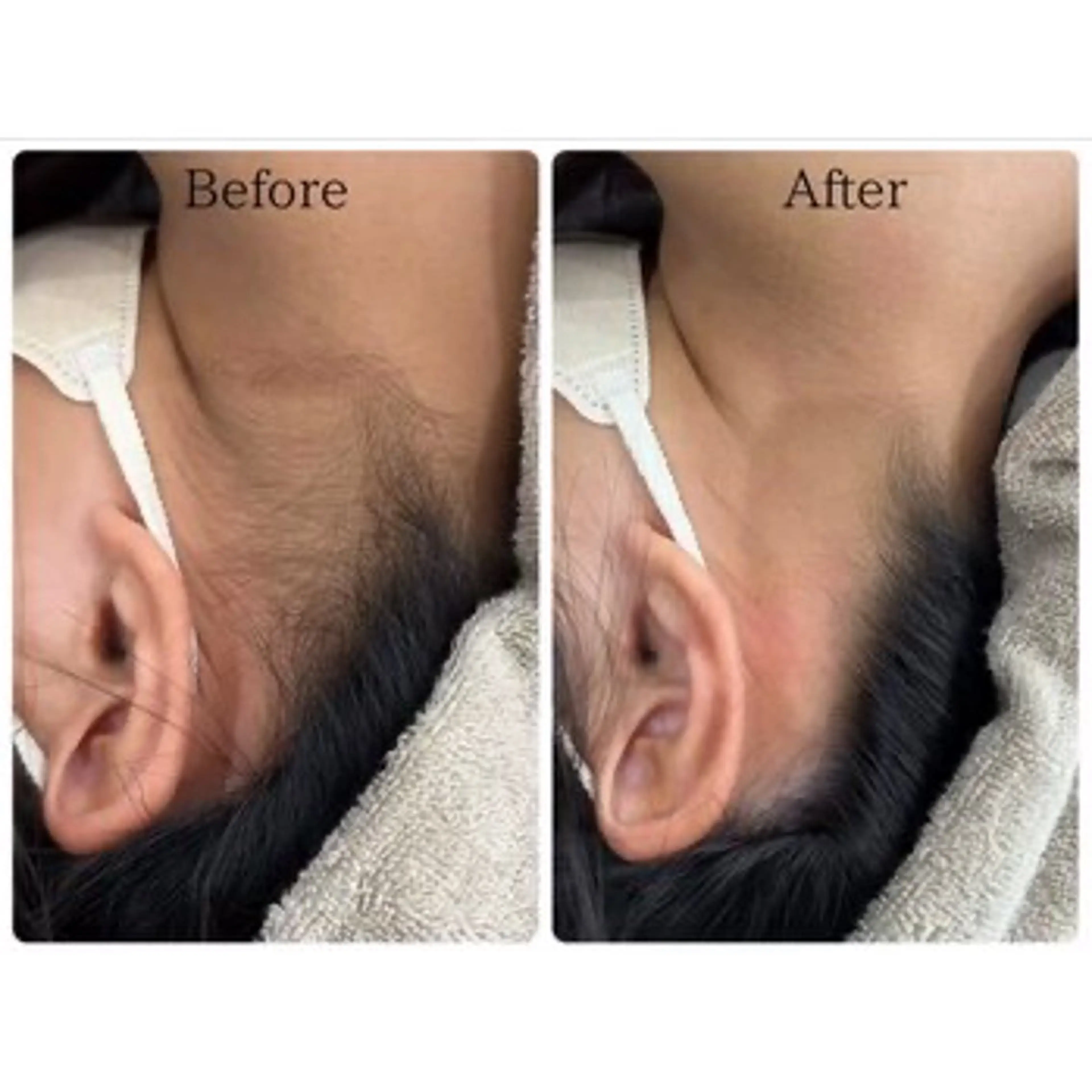 脱毛 LiLL by Andre beauty所属・LiLL 熊本のエステ・リラクイメージ