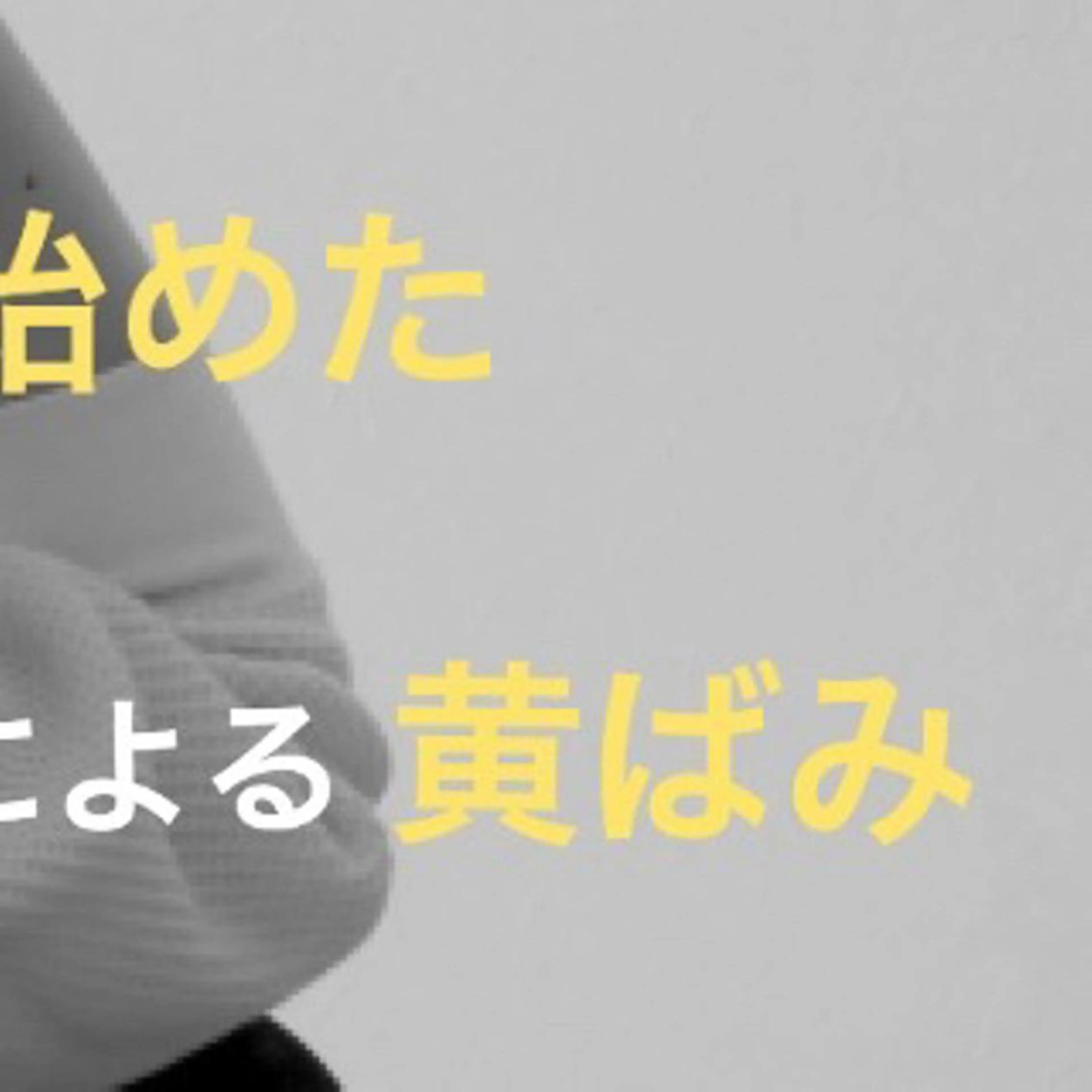 ショート カラー パーマ ヘアアレンジ メンズ キッズ ネイル マツエク・マツパ アイブロウ ホワイト その他 セルフホワイトニング サロンMW稲毛店のその他イメージ