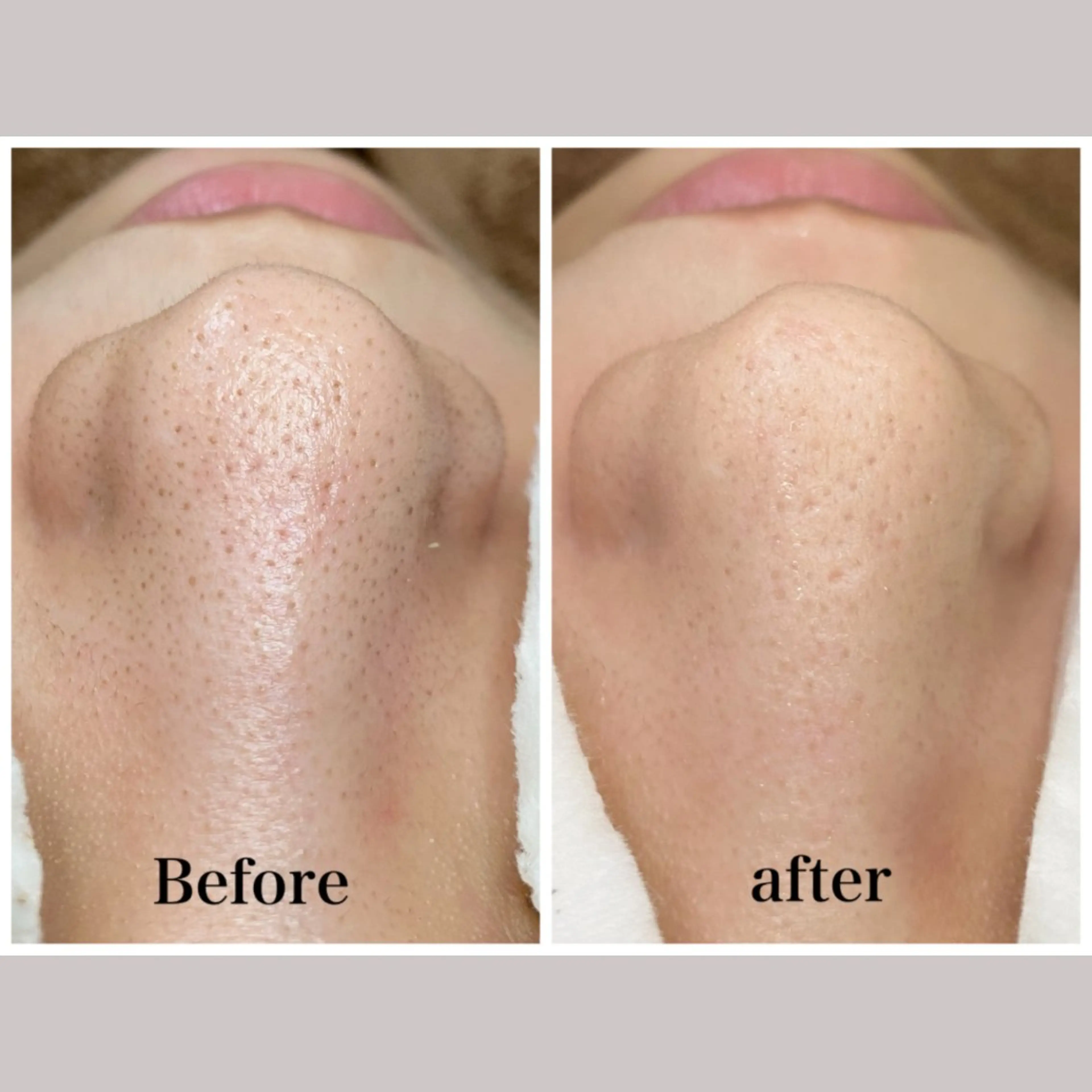 エステ リラク 韓国肌管理 【毛穴専科】のエステ・リラクイメージ