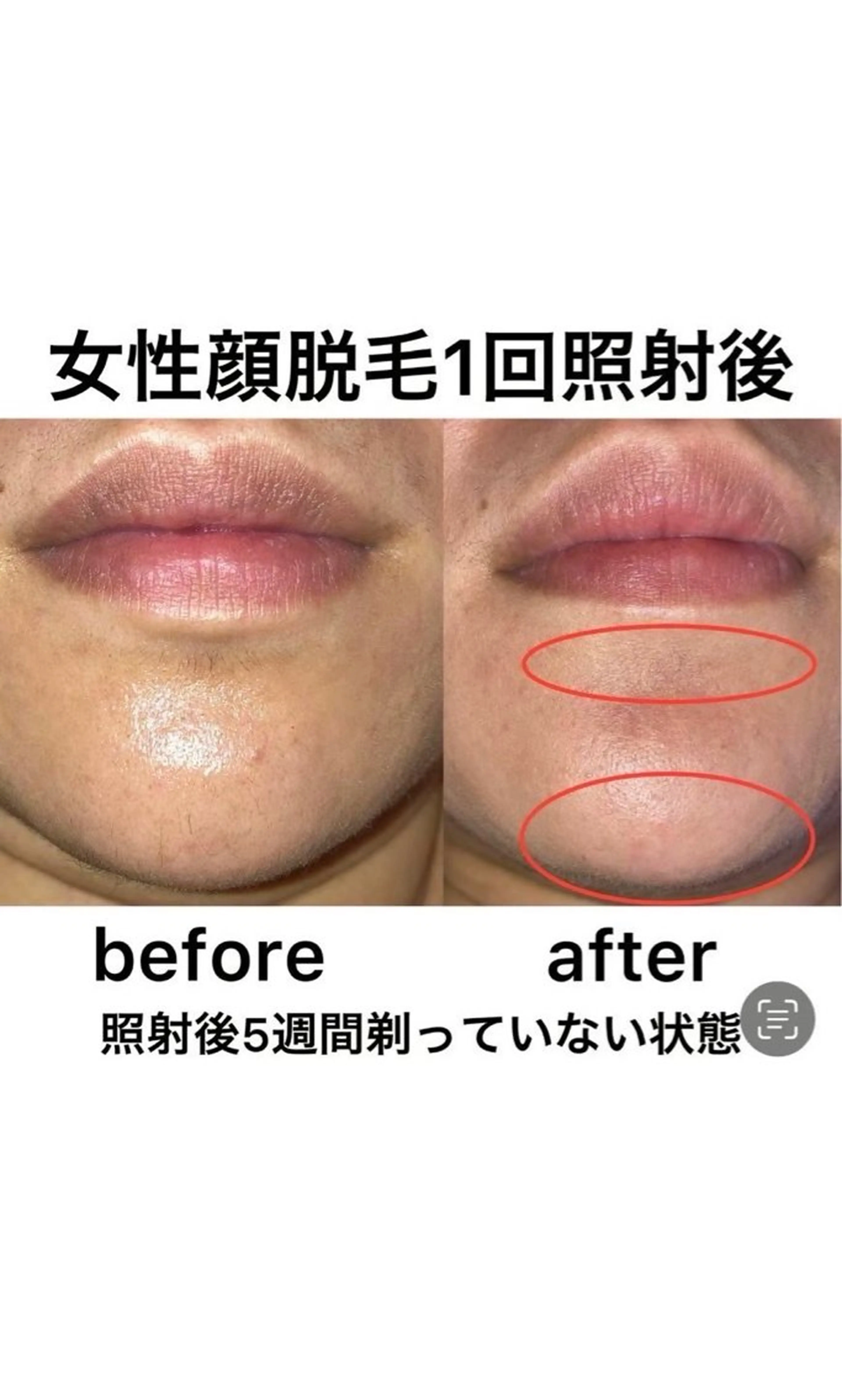 小野 優海のネイルデザイン