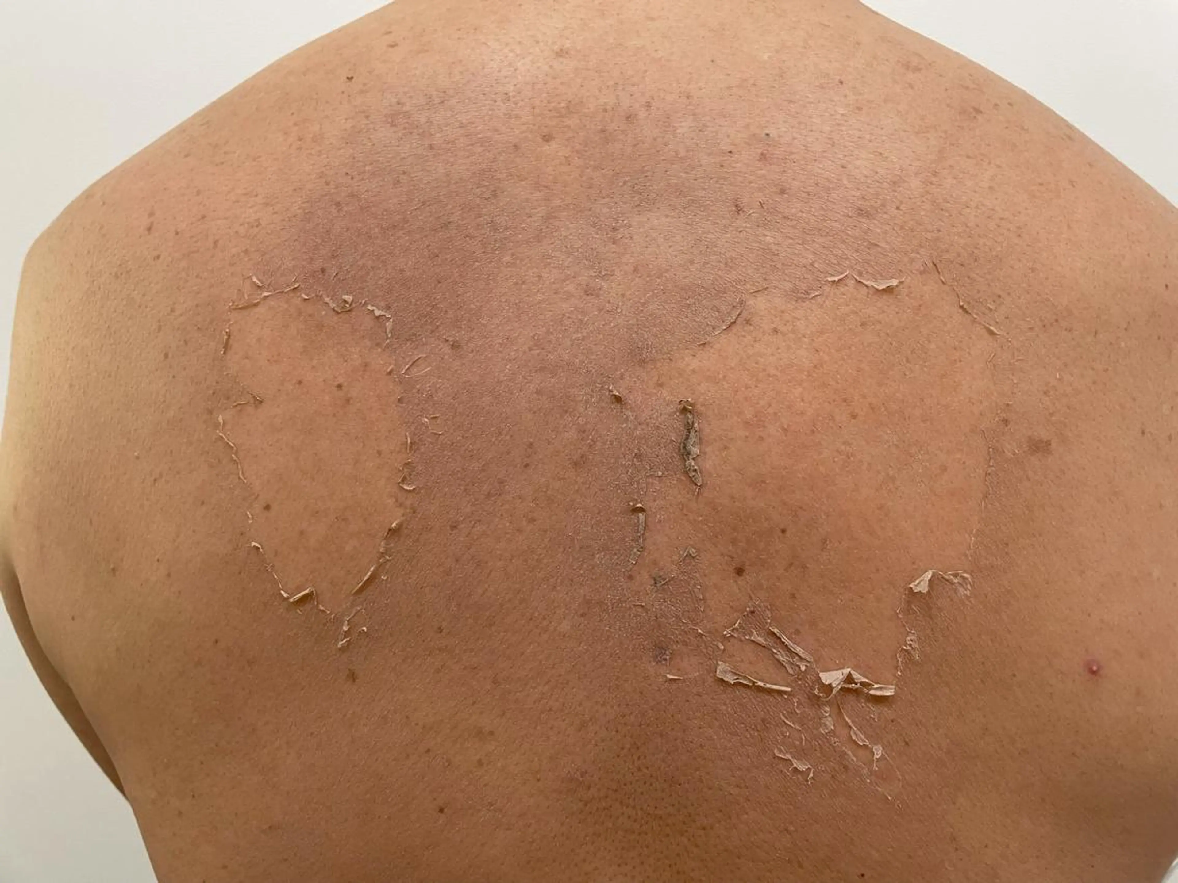 エステ グリーンピール専門店 🌿エルモナのエステ・リラクイメージ