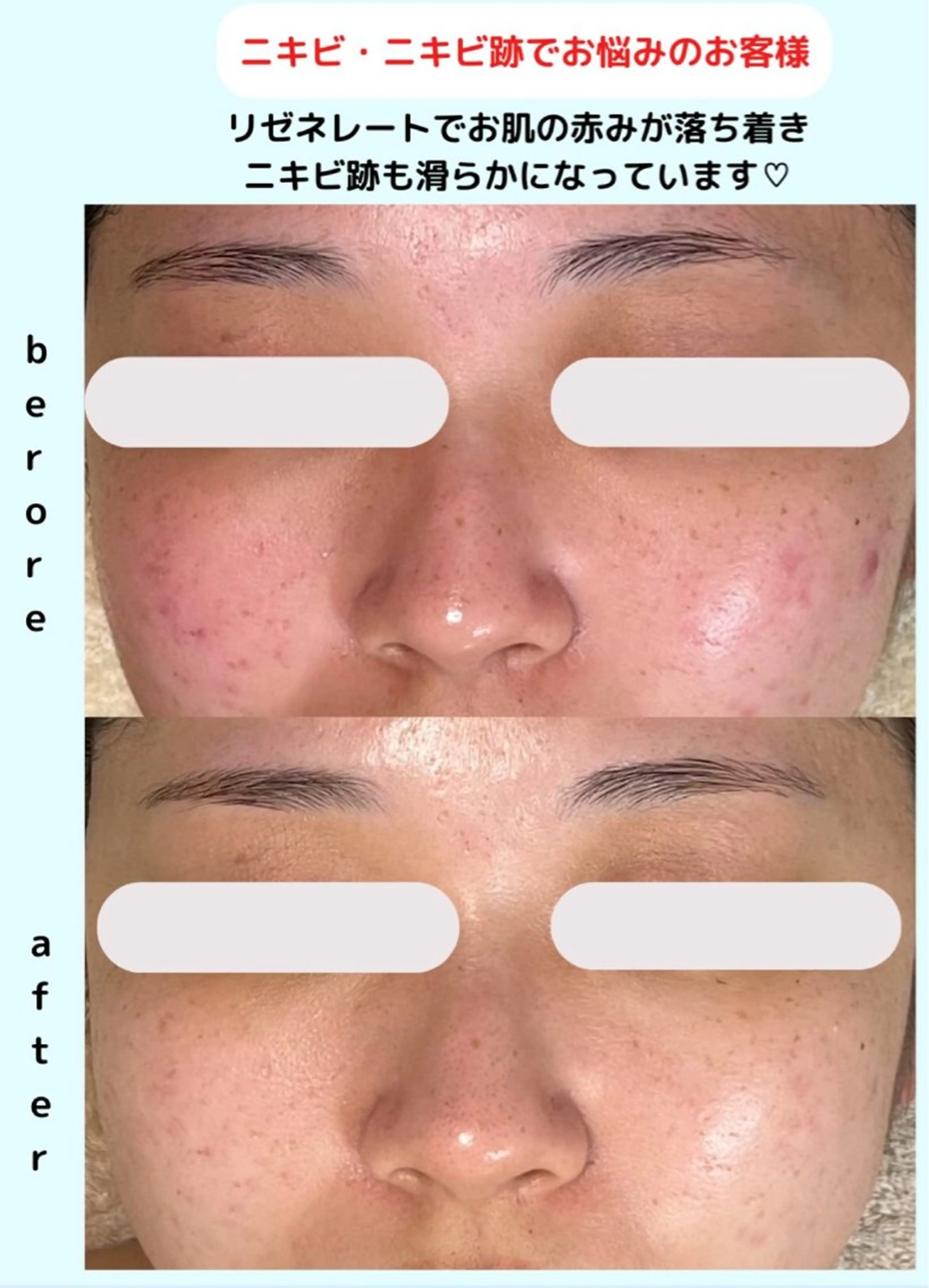 ベラージュ【美背中・ 美尻・フェイシャル】のエステ・リラクイメージ