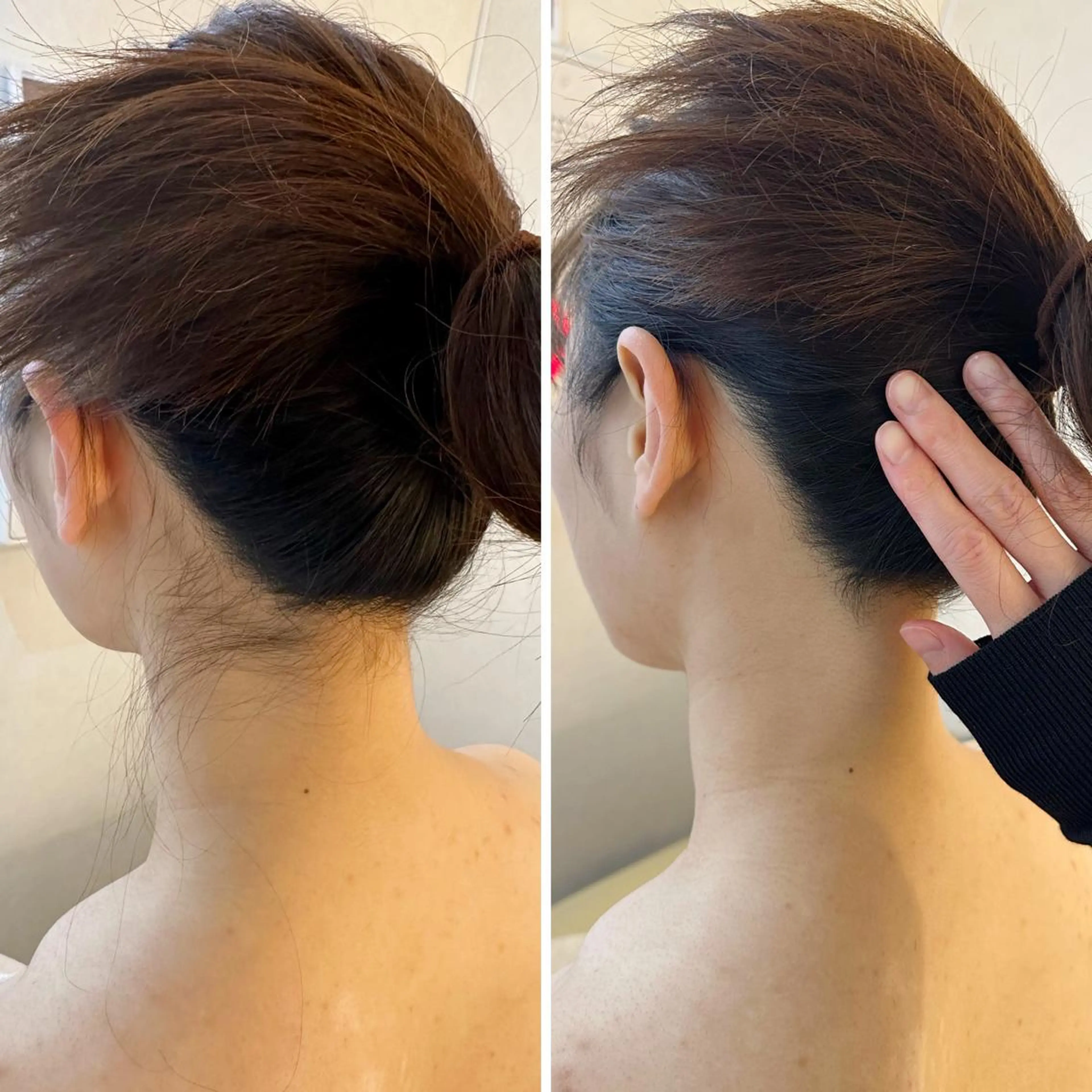 脱毛 うなじ脱毛/美肌脱毛 LABELのエステ・リラクイメージ