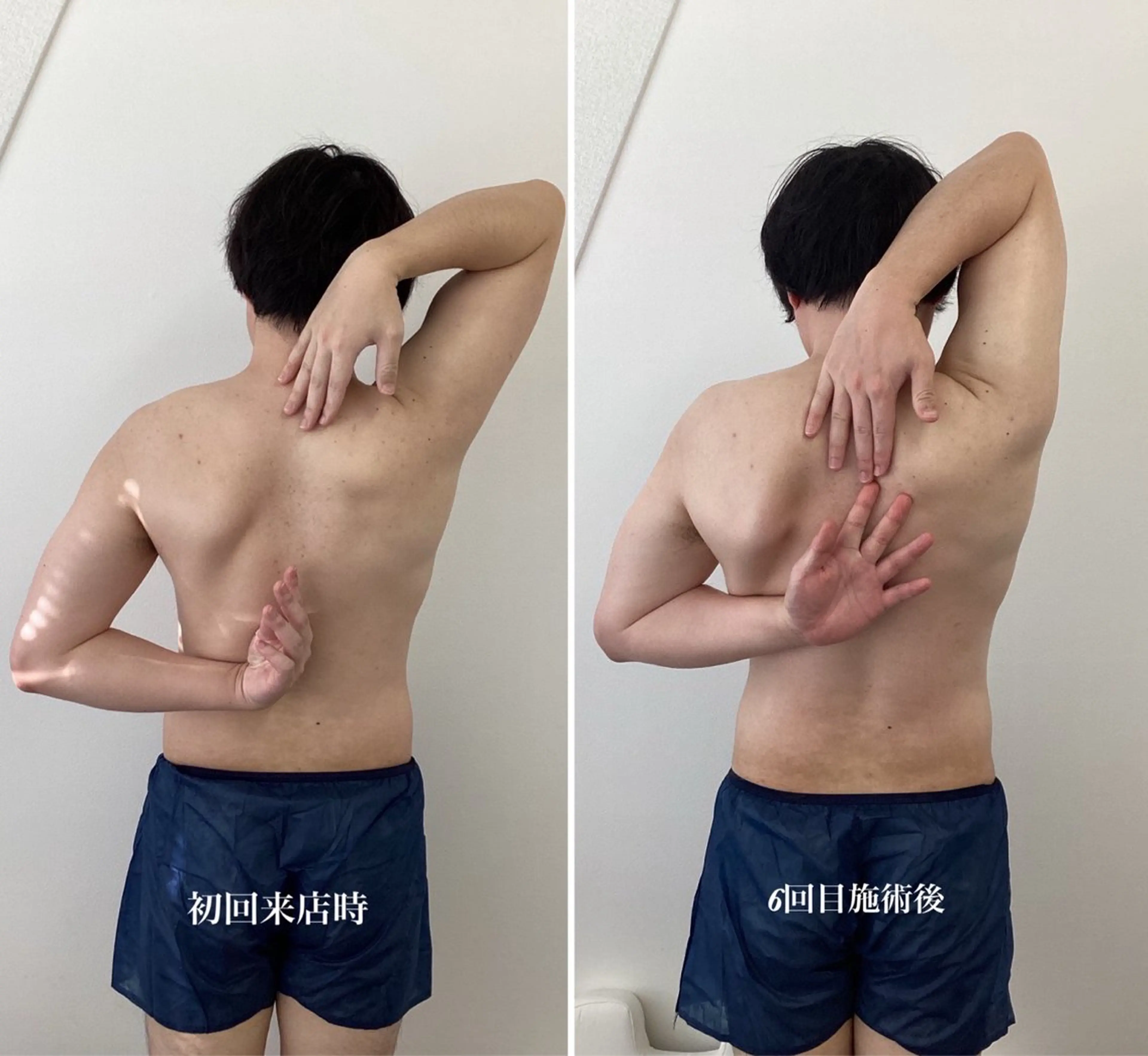 \✨ミニモ限定価格✨/ 首・肩集中コース🌟 肩こりスッキリ&姿勢改善!🧸【筋膜リリース】の写真