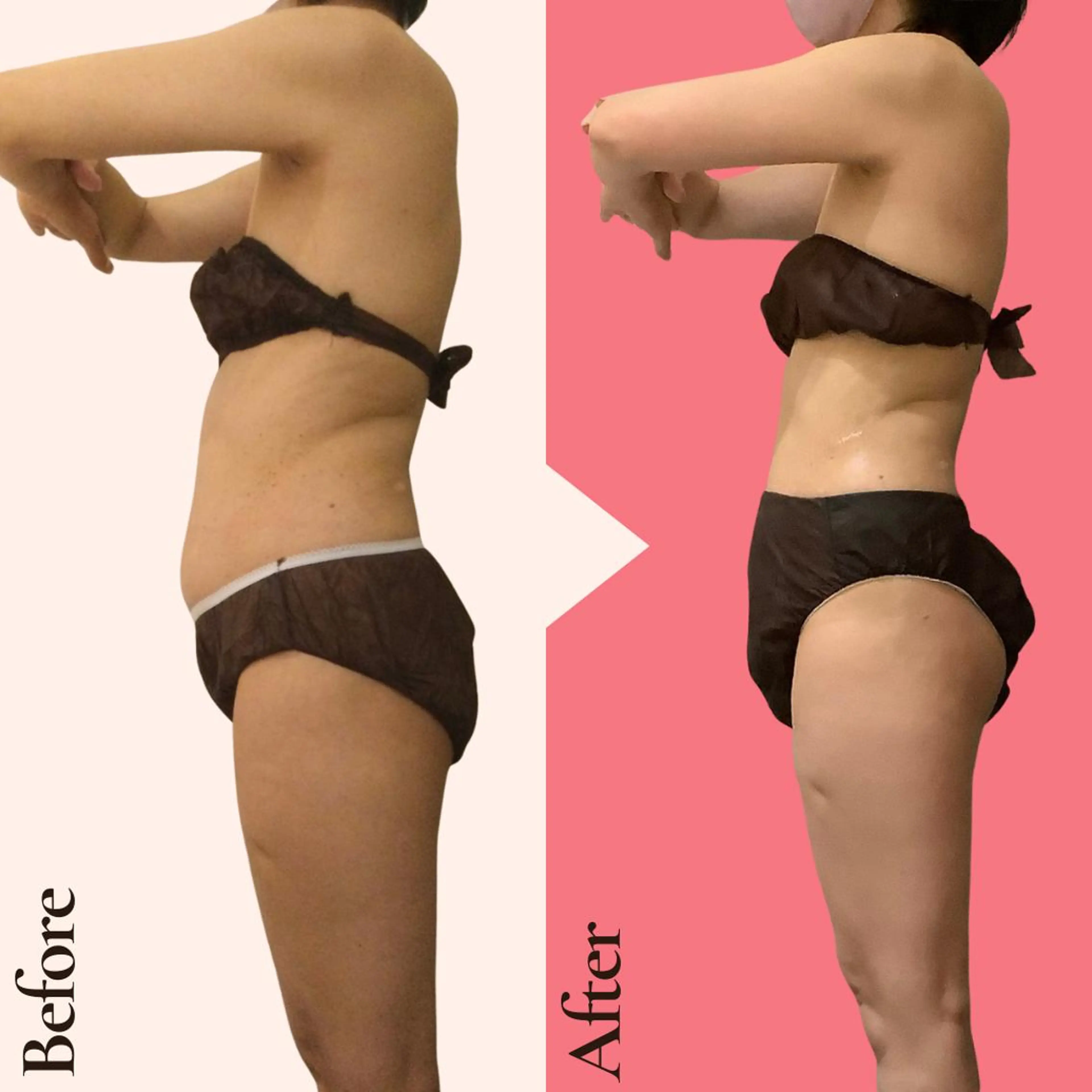 エステ リラク 痩身ダイエット専門店 プレシャスのエステ・リラクイメージ