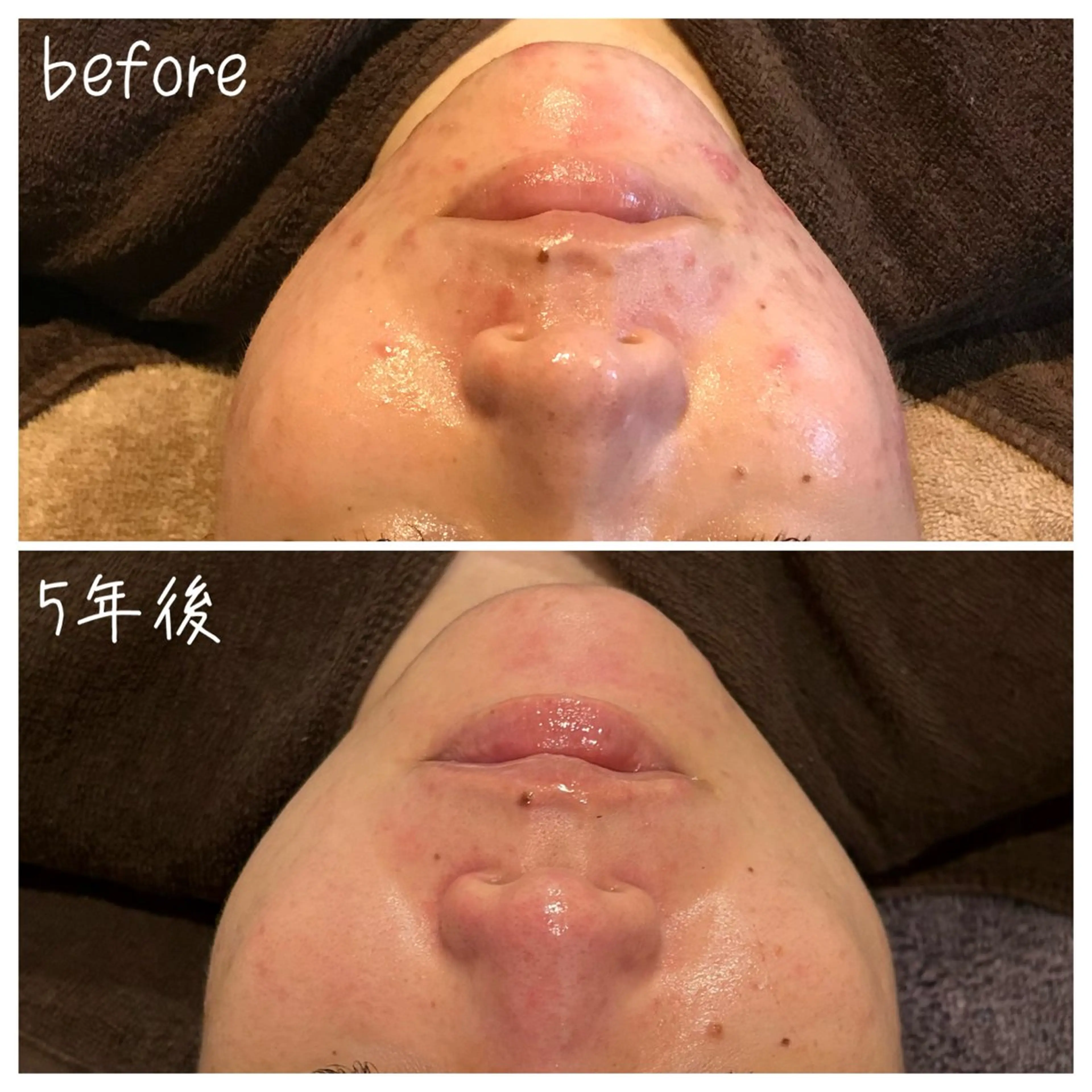 エステ 浜野 恵美のエステ・リラクイメージ