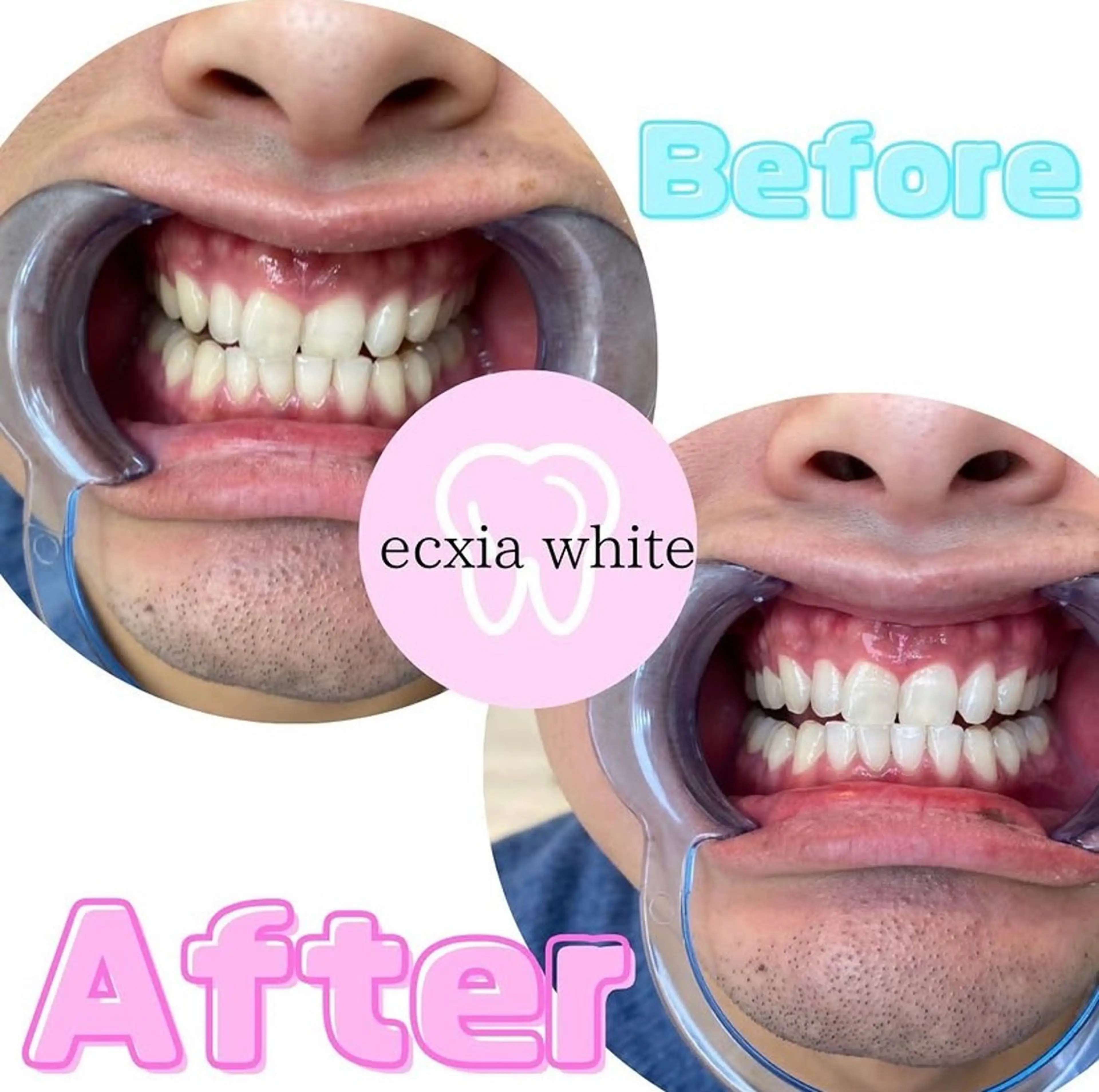 その他 nanami -ホワイトニングのその他イメージ