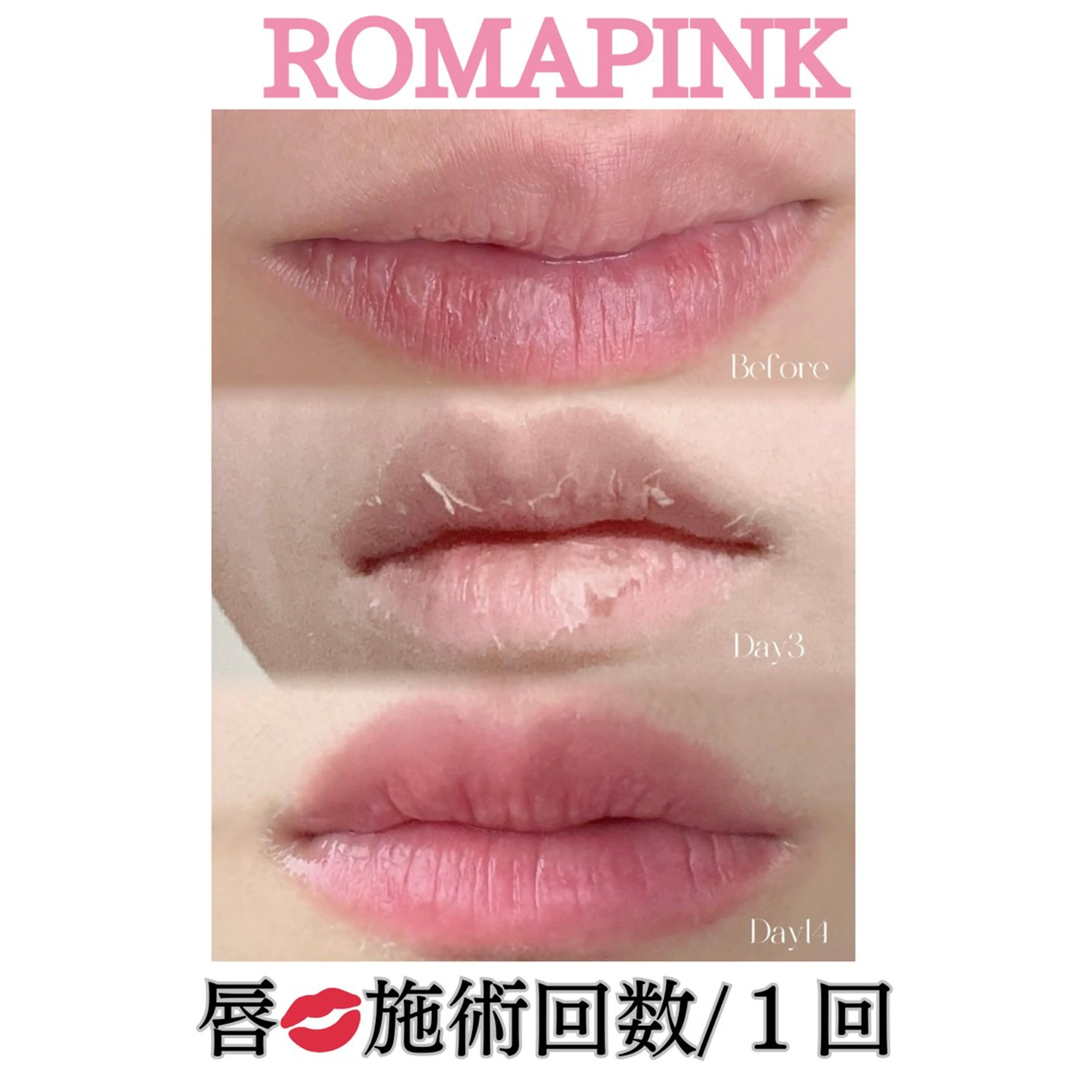 トータルビューティー サロンSalaのマツエク・マツパデザイン