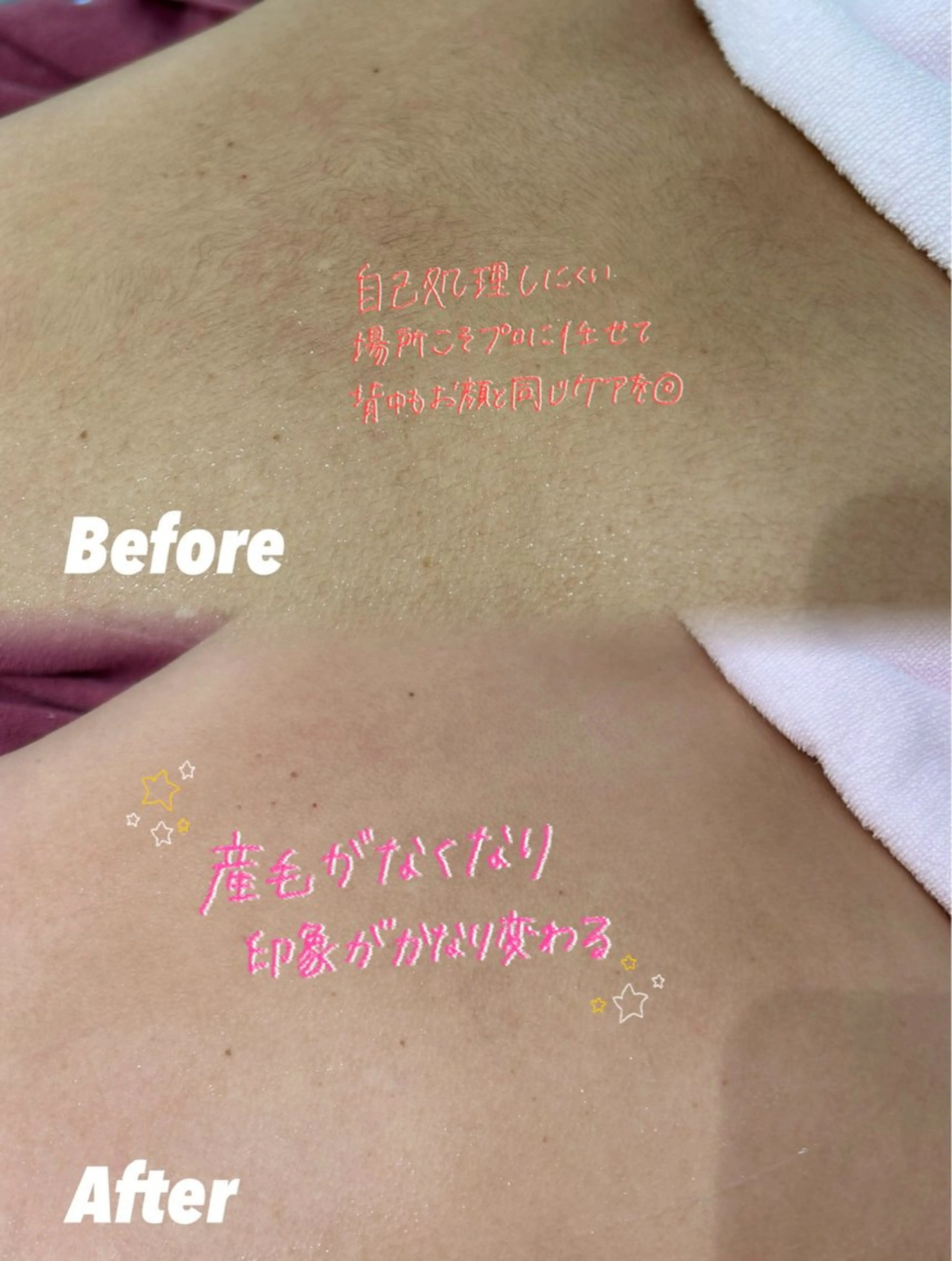 その他 🫧美しい素肌へ🫧 今成柚乃のその他イメージ