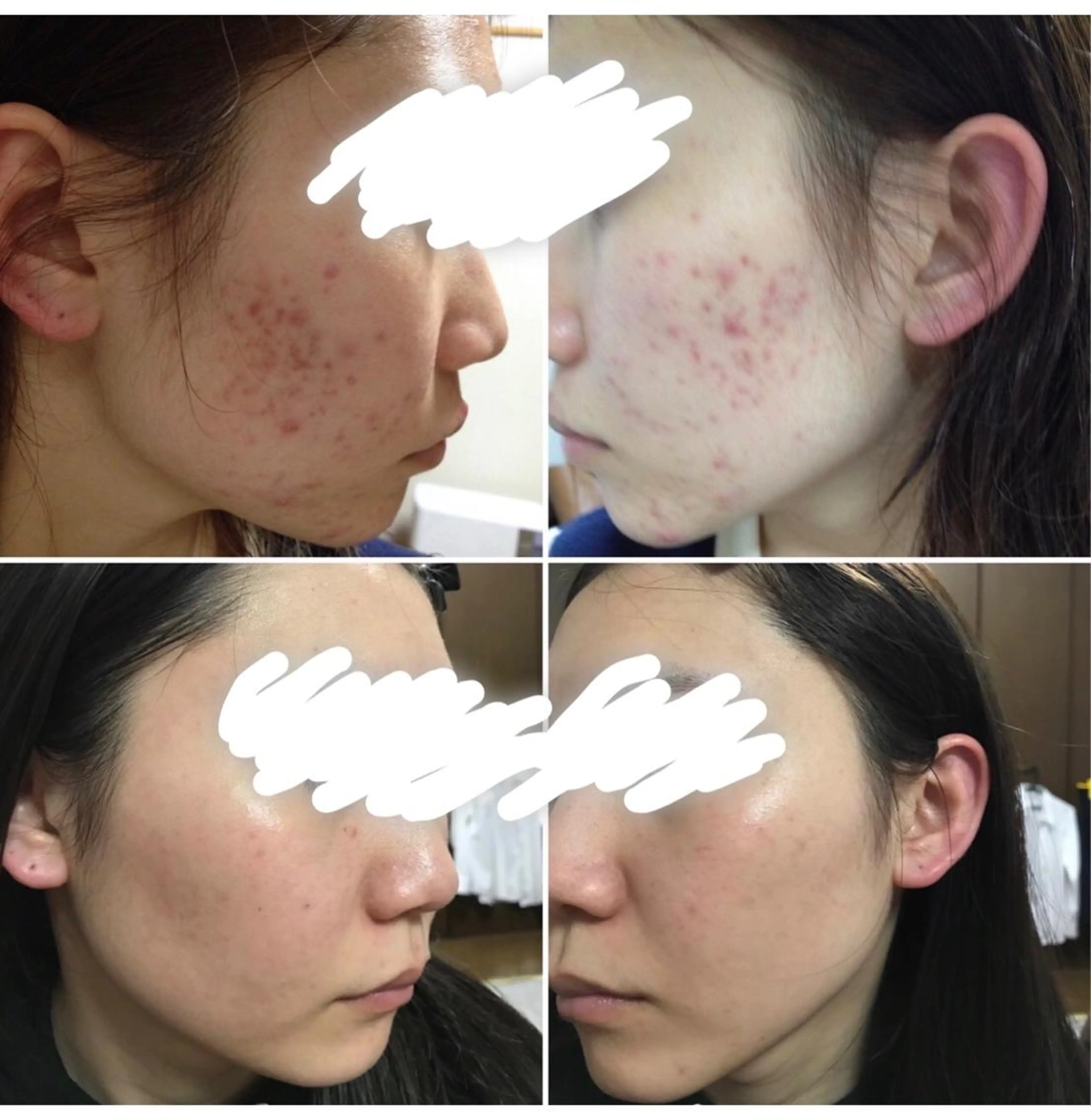 ミディアム カラー パーマ ヘアアレンジ メンズ キッズ ネイル マツエク・マツパ エステ ニキビ&跡改善サロン オーナー光木のエステ・リラクイメージ