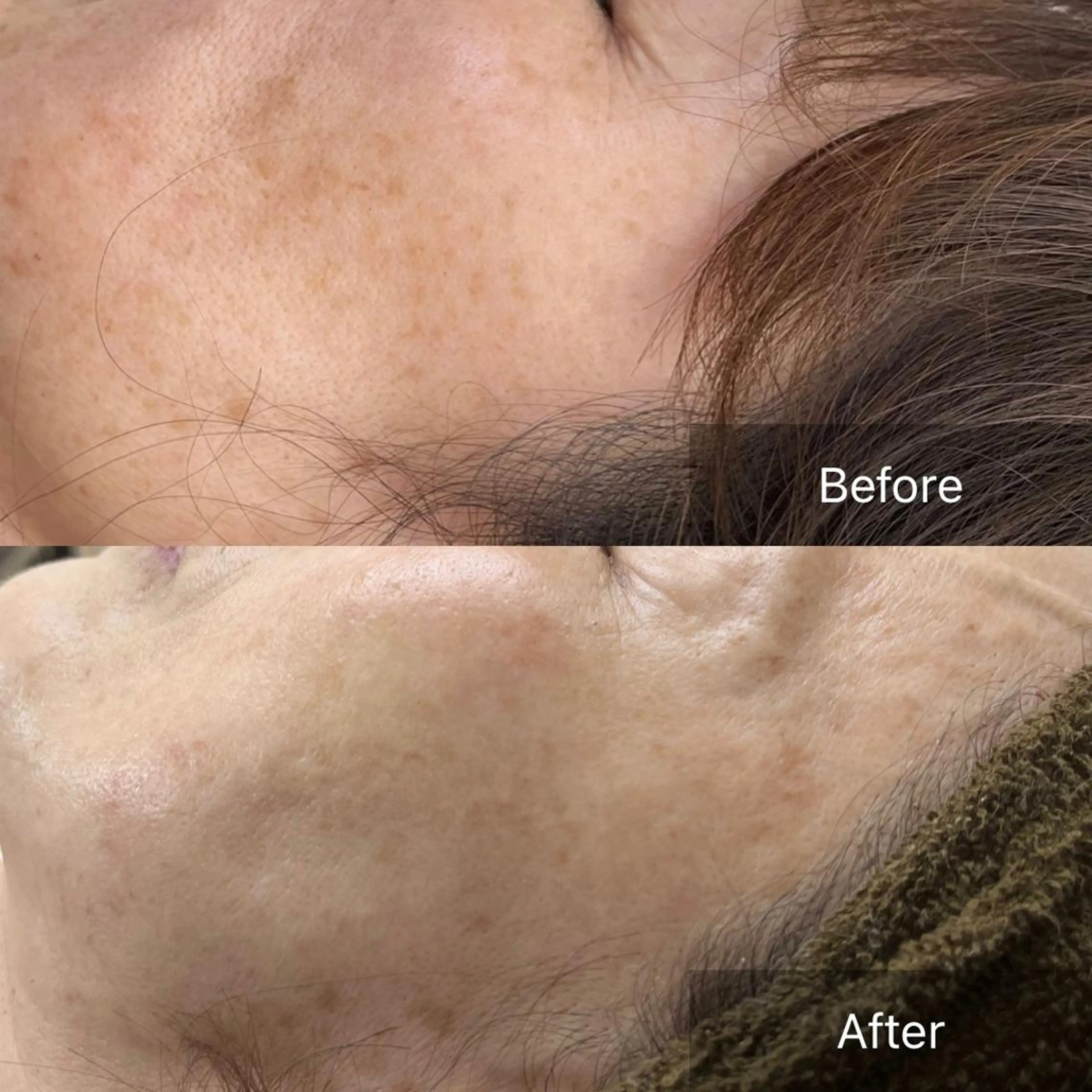 BeautySalo nCielChibaのエステ・リラクイメージ