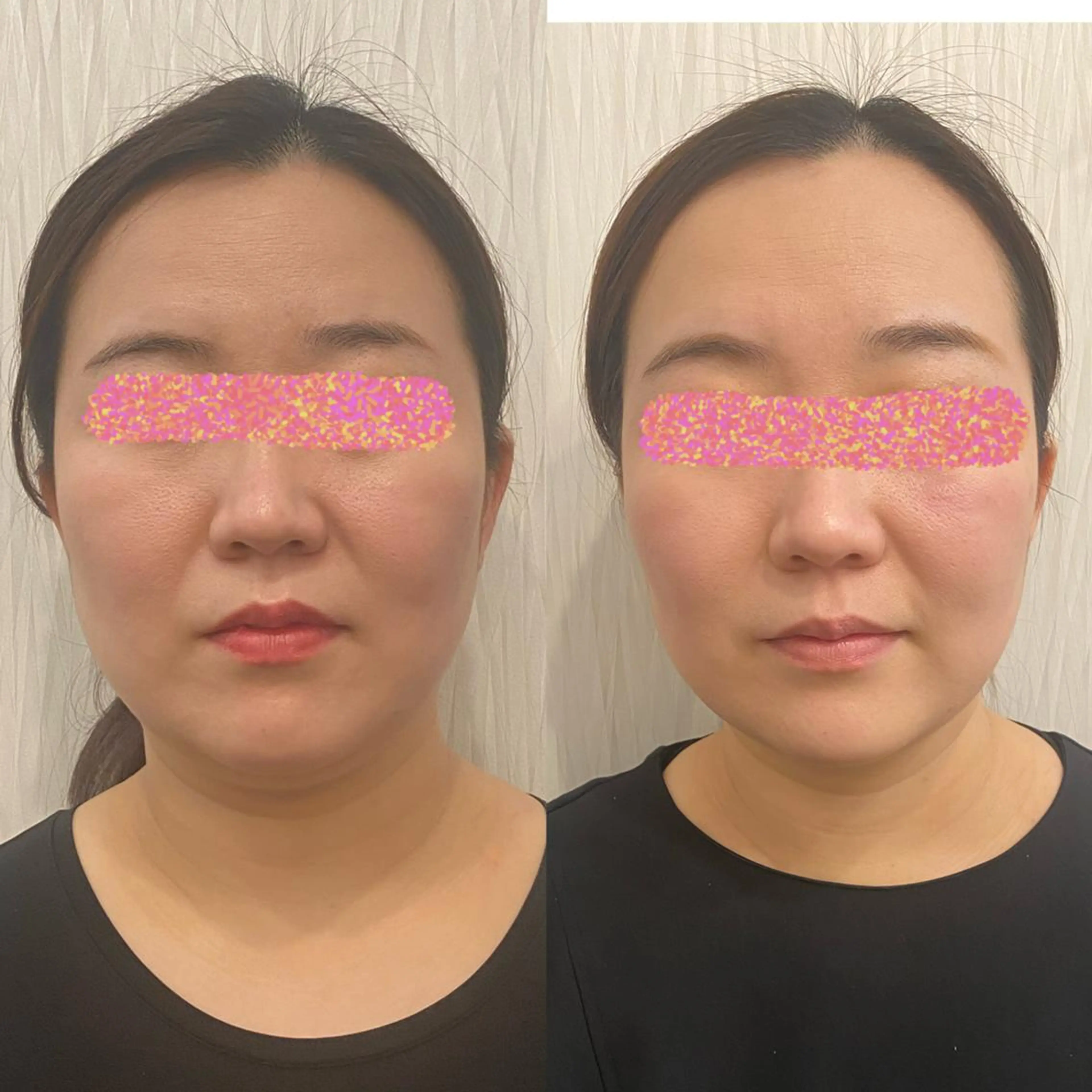 エステ OPREA 栄店のエステ・リラクイメージ