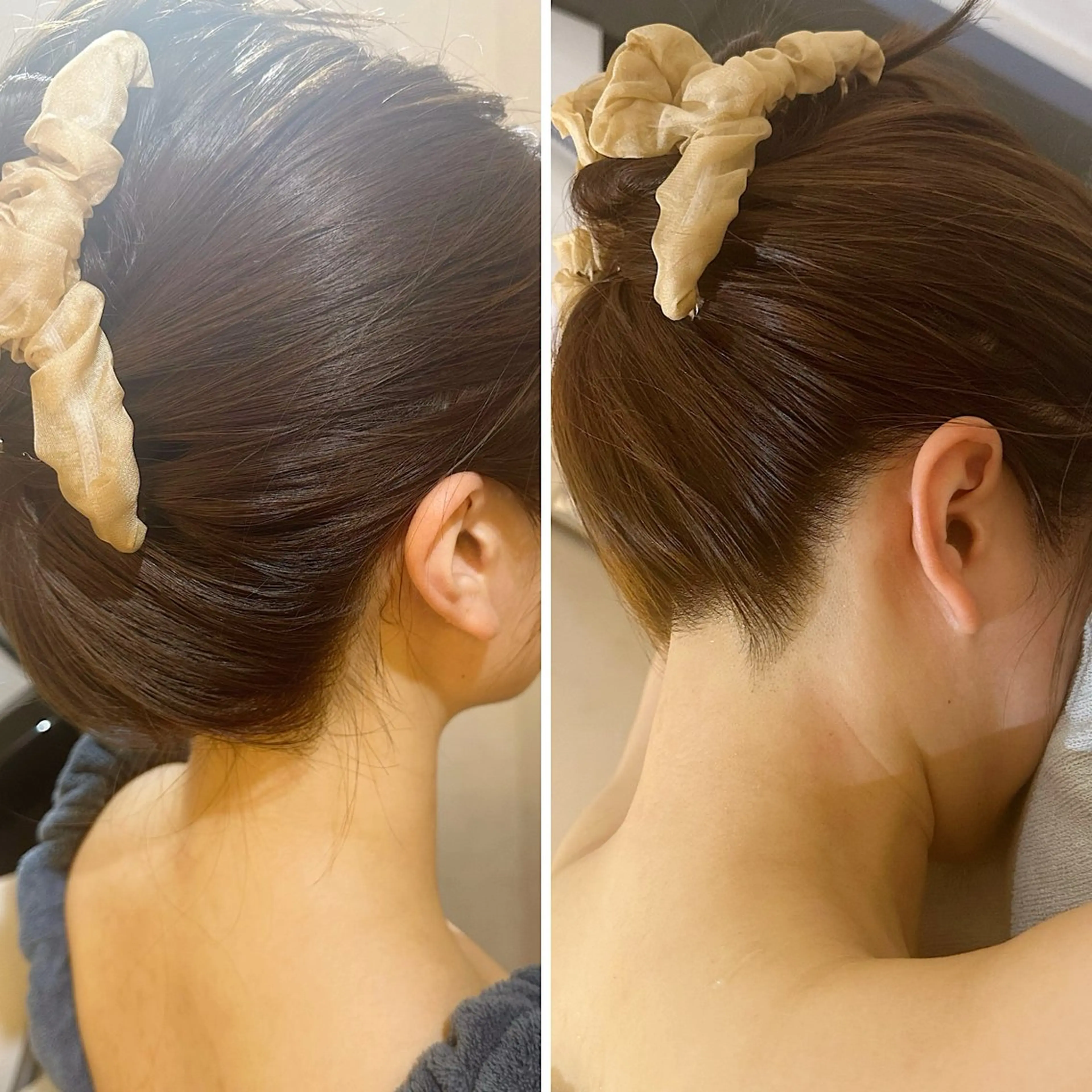 脱毛 うなじ脱毛/美肌脱毛 LABELのエステ・リラクイメージ