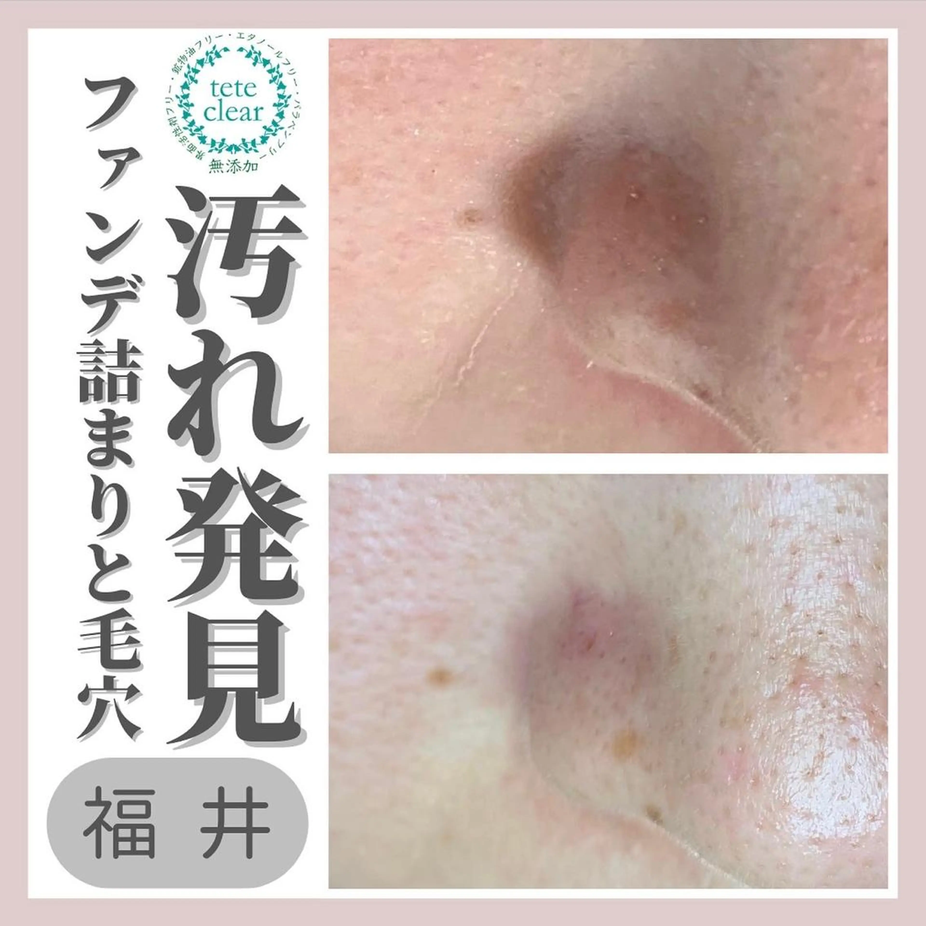 毛穴肌質ケアサロン Yourmeユアミーのエステ・リラクイメージ