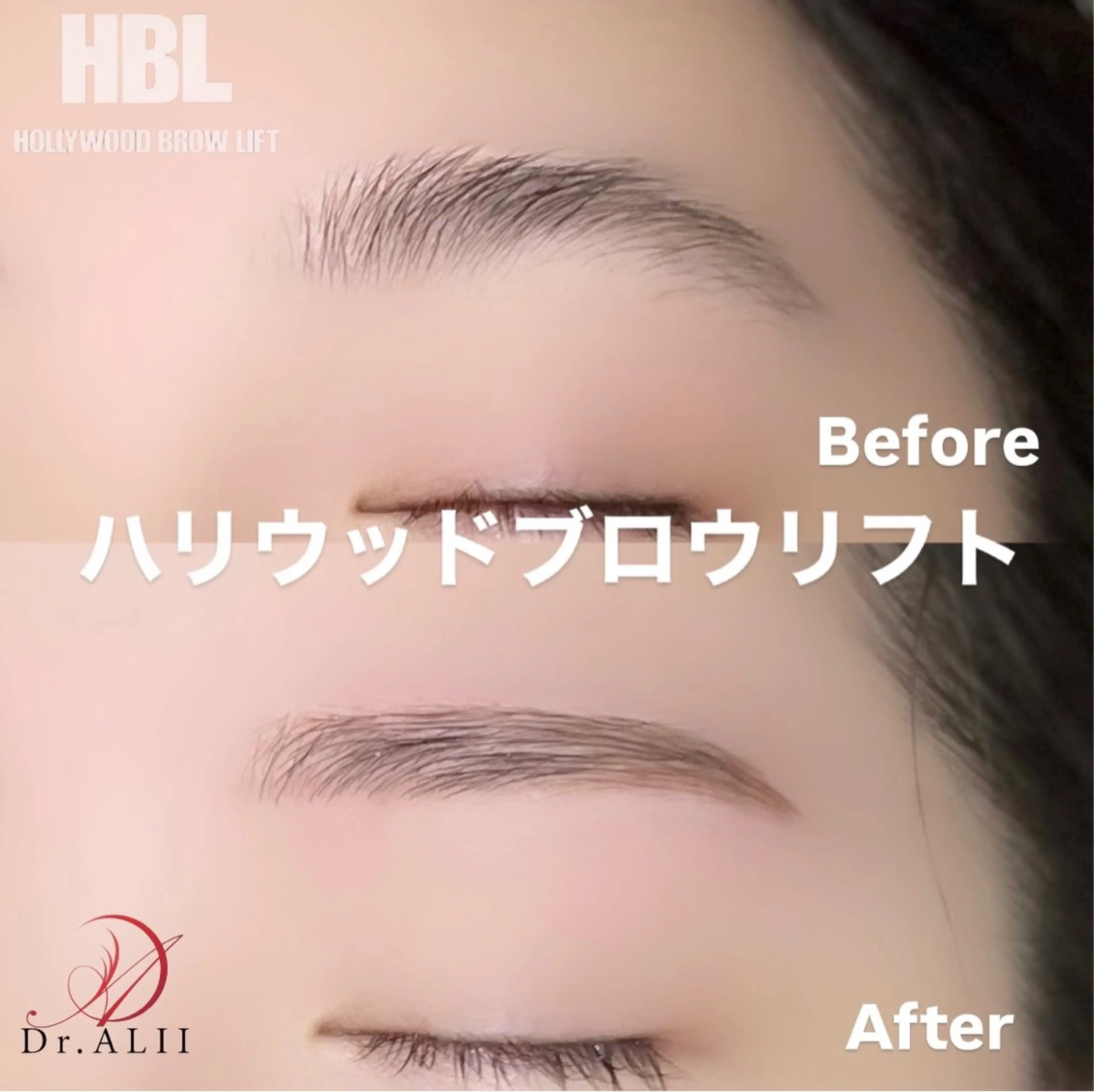 アイブロウ ハリウッドブロウリフト ワックス脱毛 その他(アイブロウ) Dr.ALII岐南店所属・Dr.ALII 岐南店　鈴村のエステ・リラクイメージ