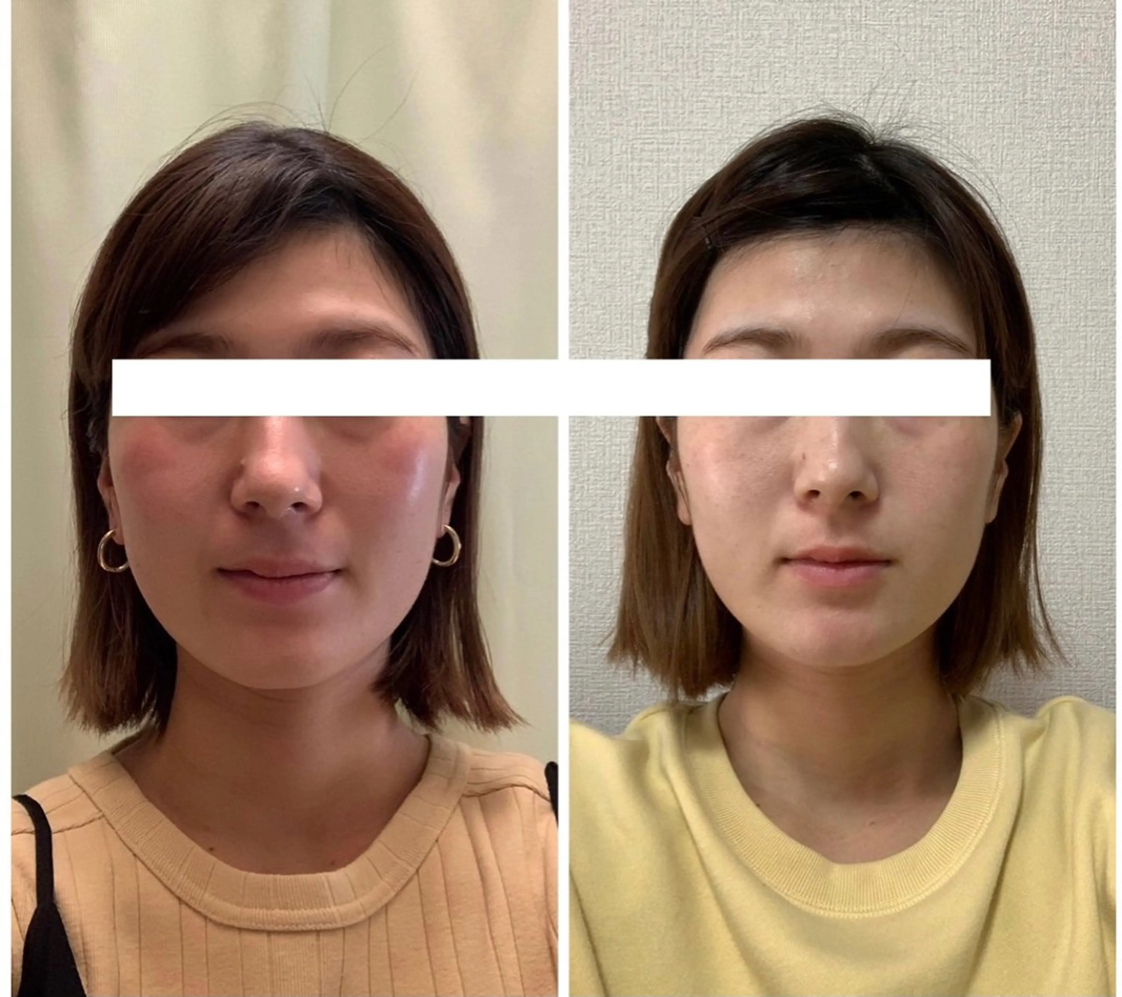 丸顔さんの救世主 高田 くみのエステ・リラクイメージ