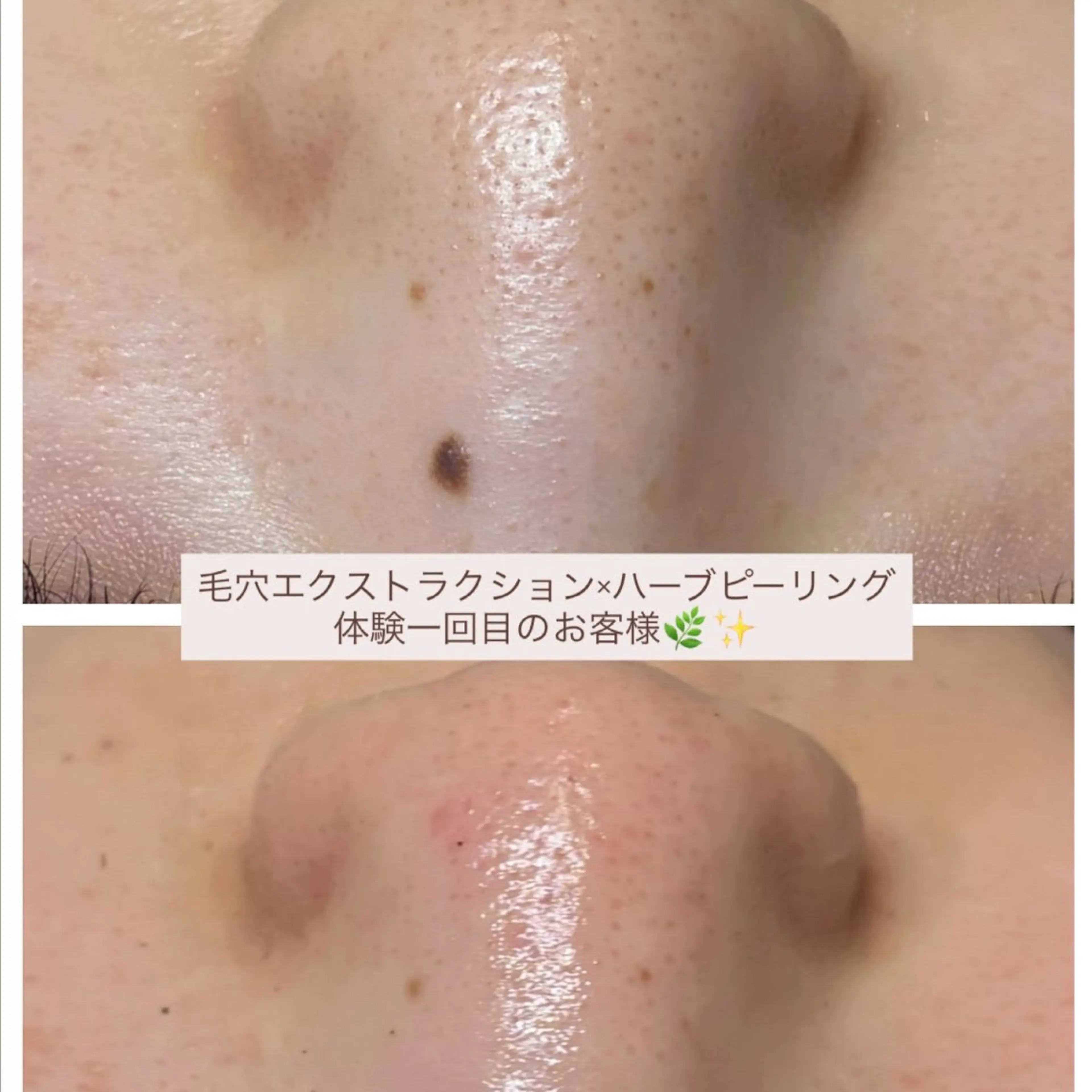 uni. abeのエステ・リラクイメージ