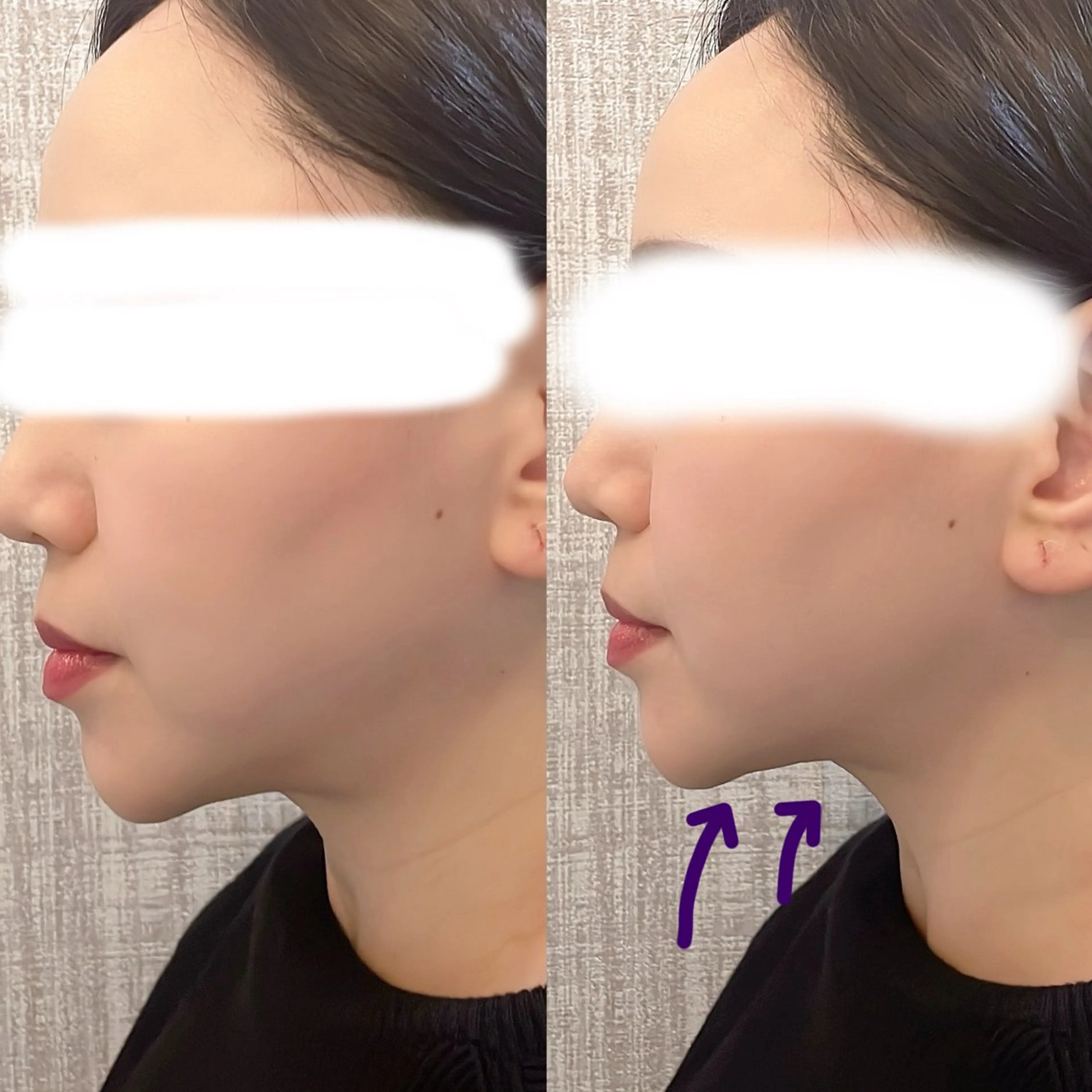 エステ 林 絵美のエステ・リラクイメージ