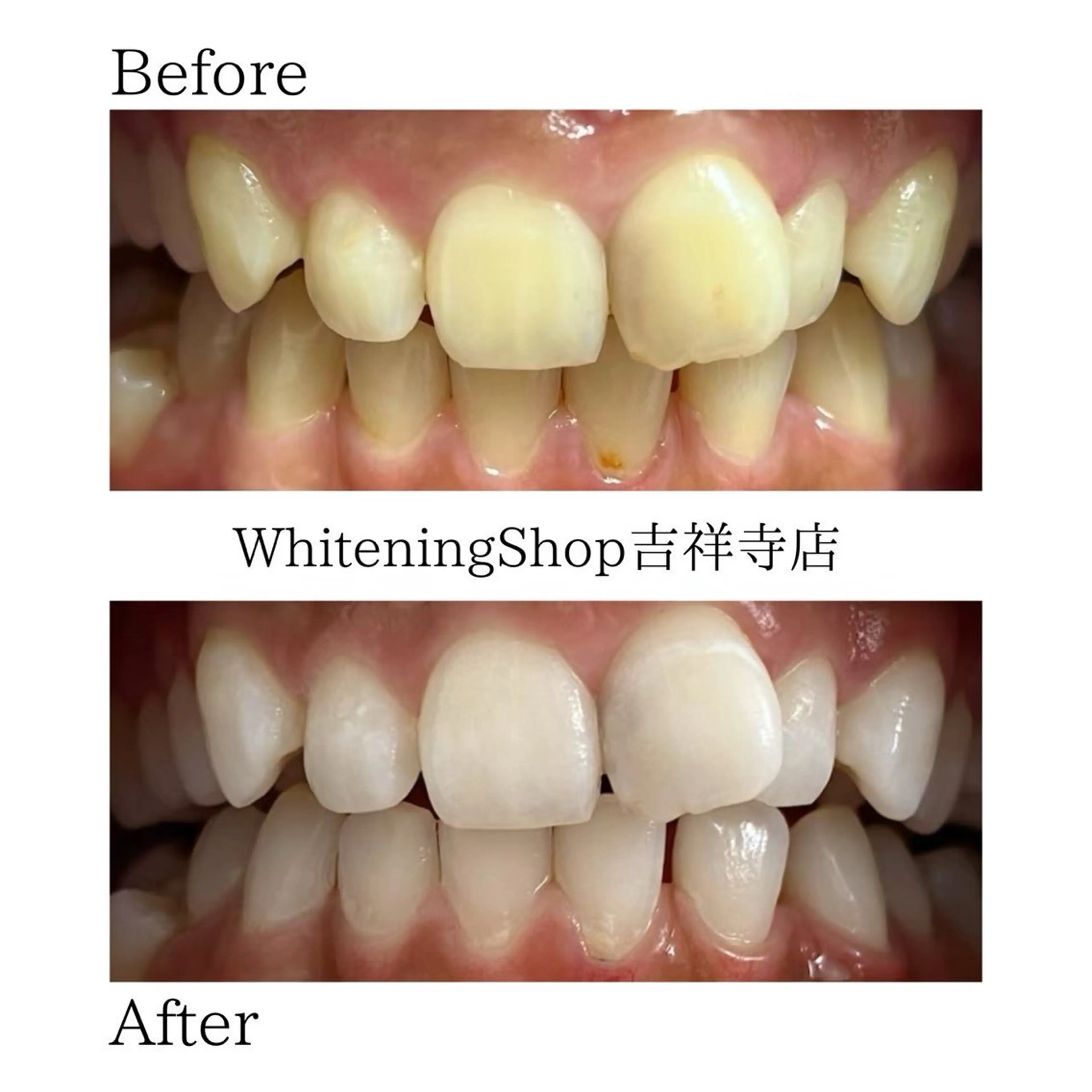 ホワイトニングショッ 吉祥寺2号店のその他イメージ