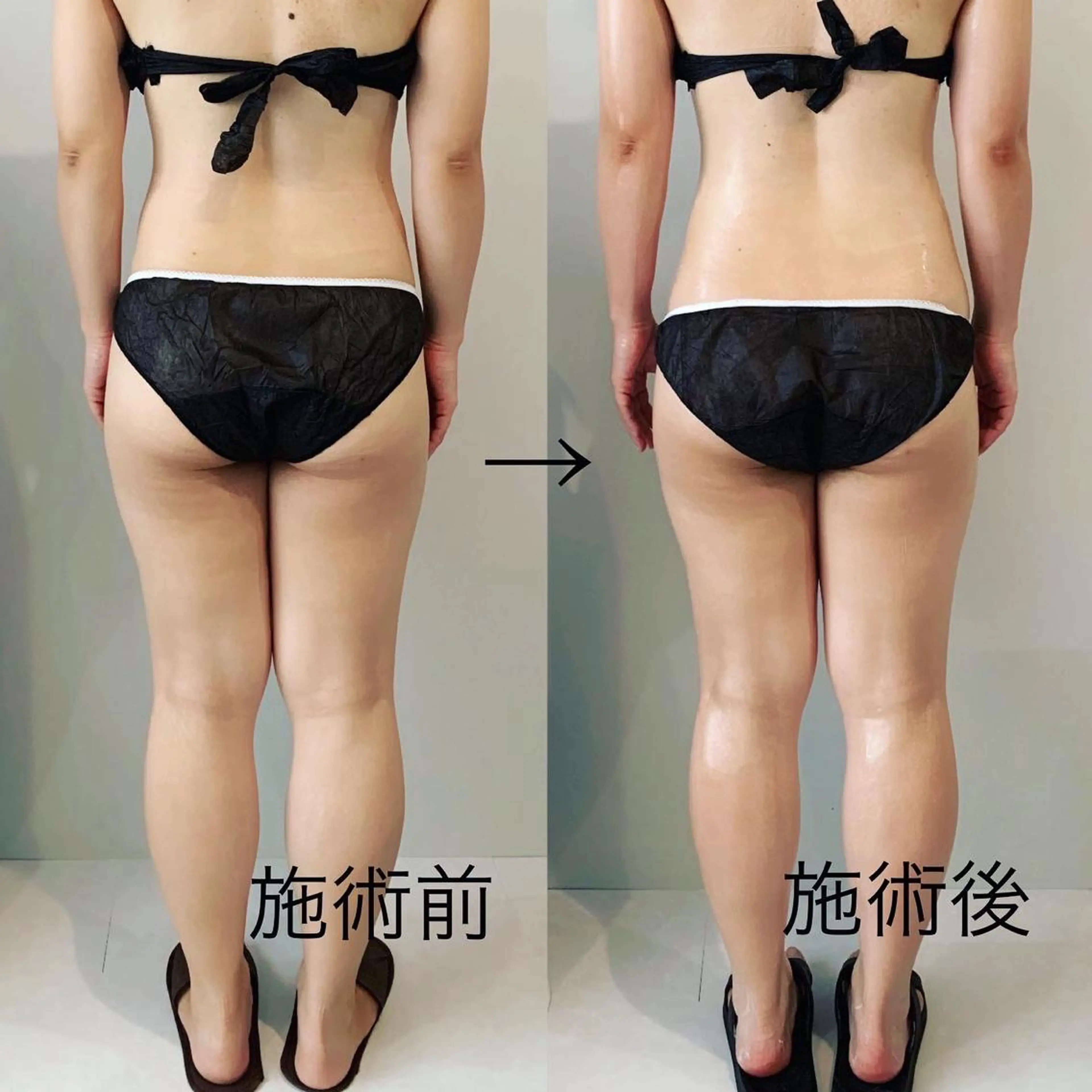 maintenance salon shinoma所属・ボディメンテナンス shinomaのエステ・リラクイメージ