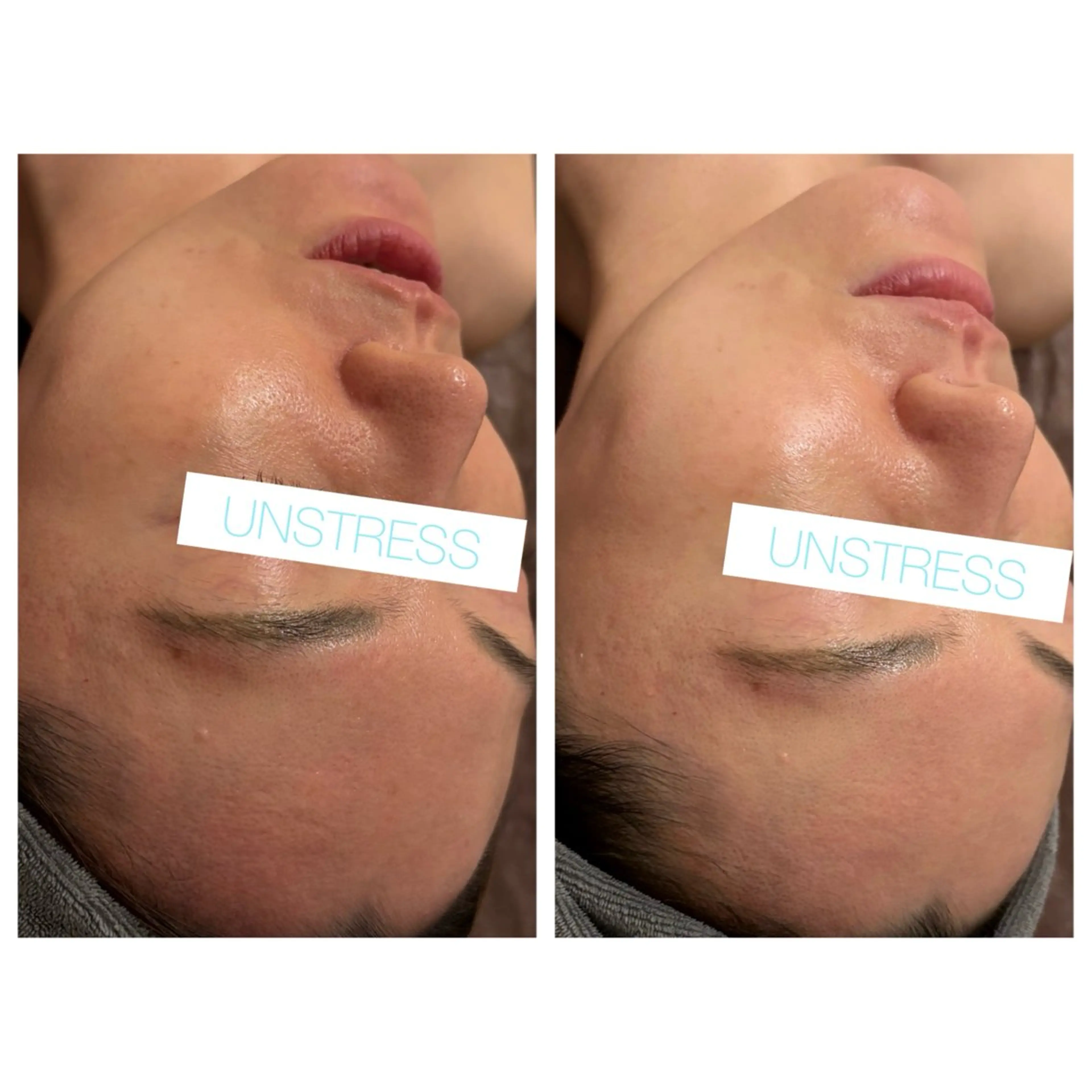 小顔コルギ ☆表参道/外苑前のエステ・リラクイメージ