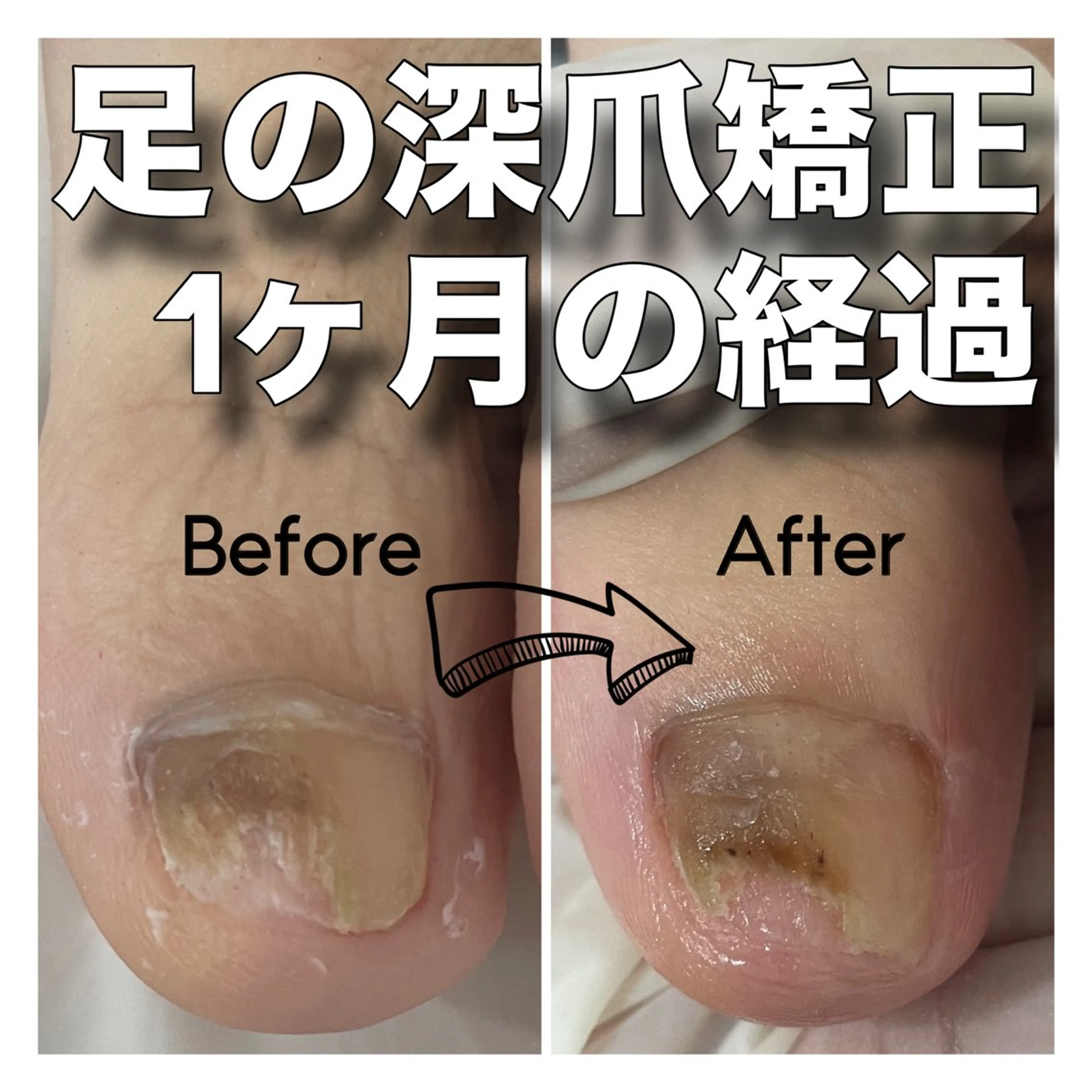 ネイル nail salon petillantのネイルデザイン