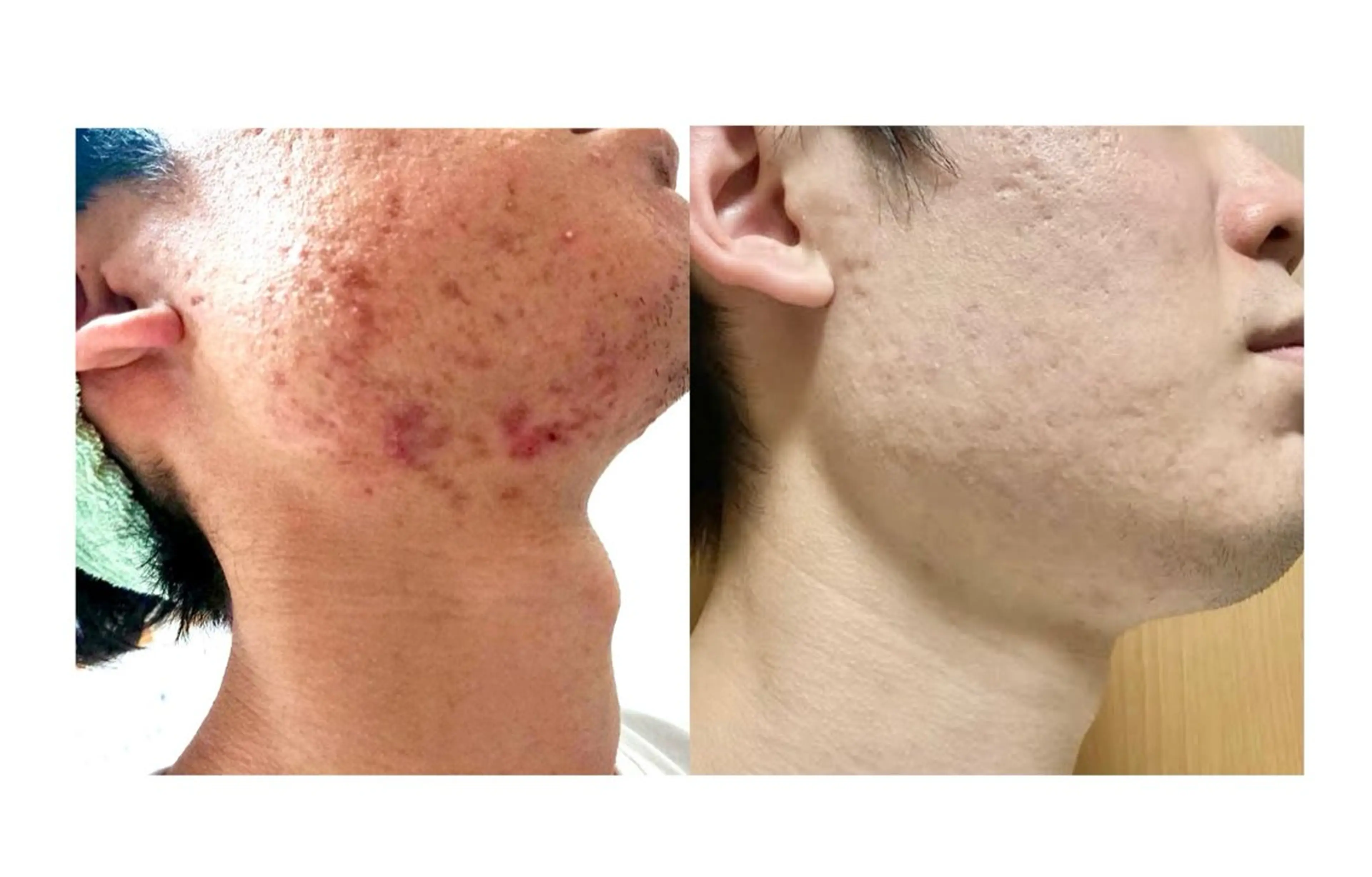 Belchic ベルシックのエステ・リラクイメージ