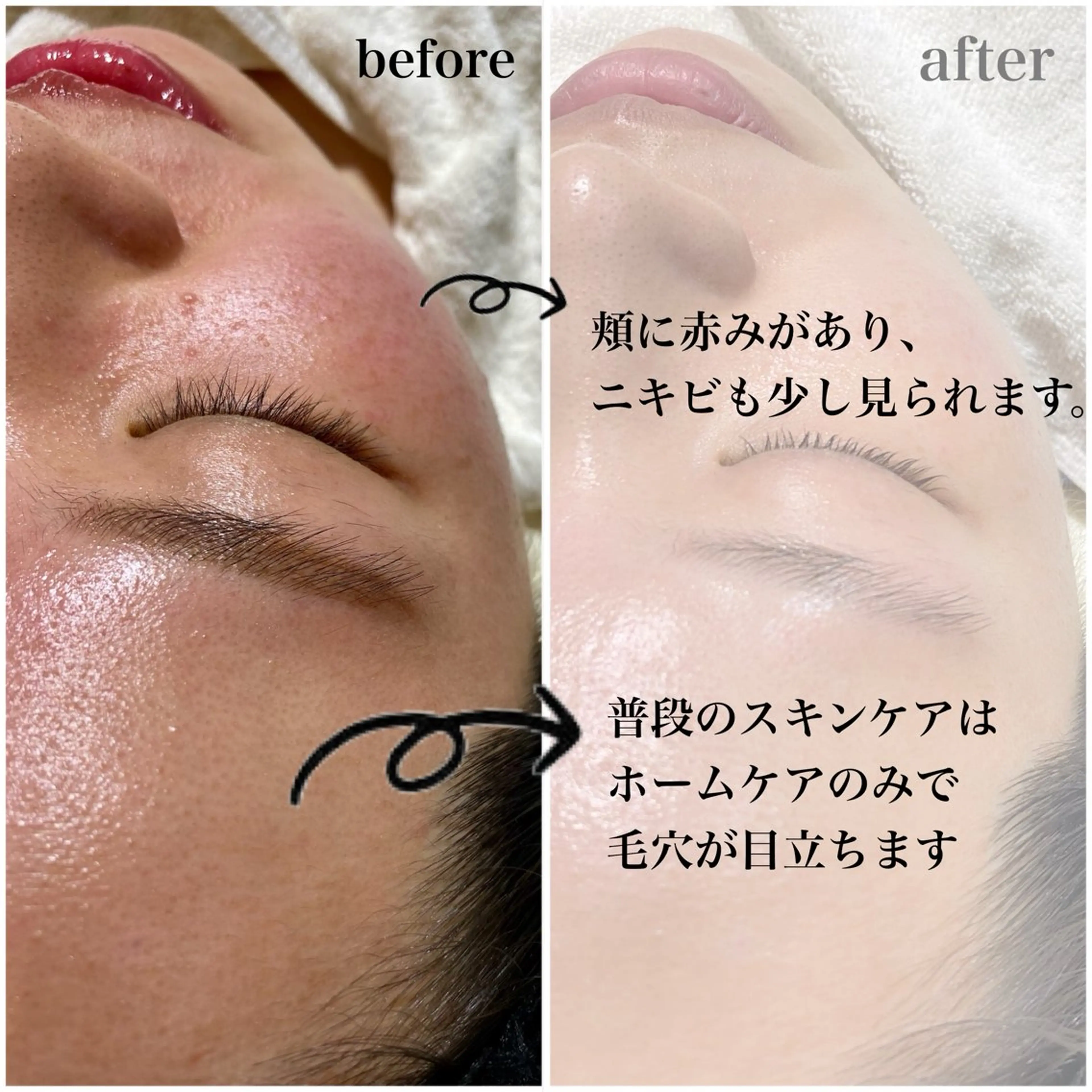 エステ Lash  One 四条店のエステ・リラクイメージ