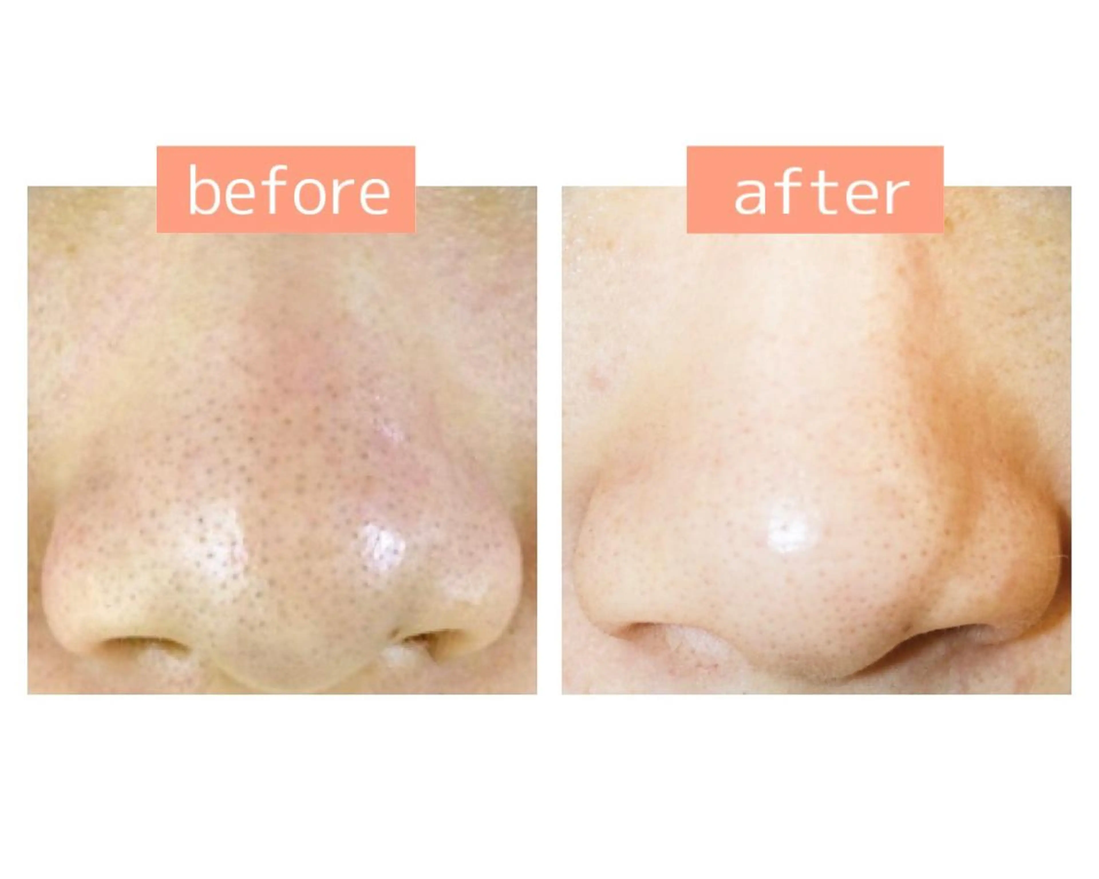 エステ Ikuta Youの眉毛・アイブロウイメージ