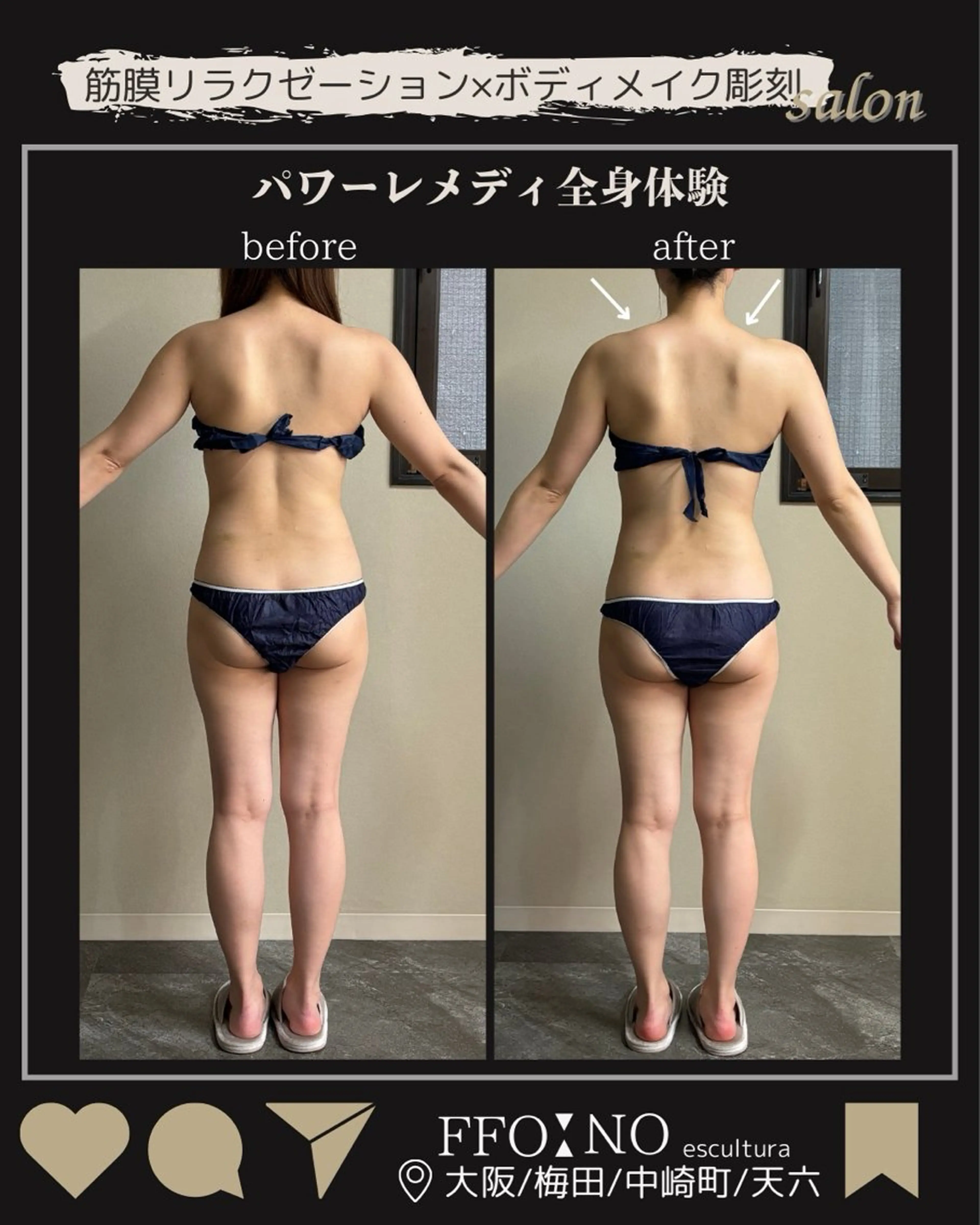 *仮予約*【60分/甘えた脂肪、目を覚ませ！】《全身スッキリ◎深層アプローチ》痩身×むくみ×コリの写真