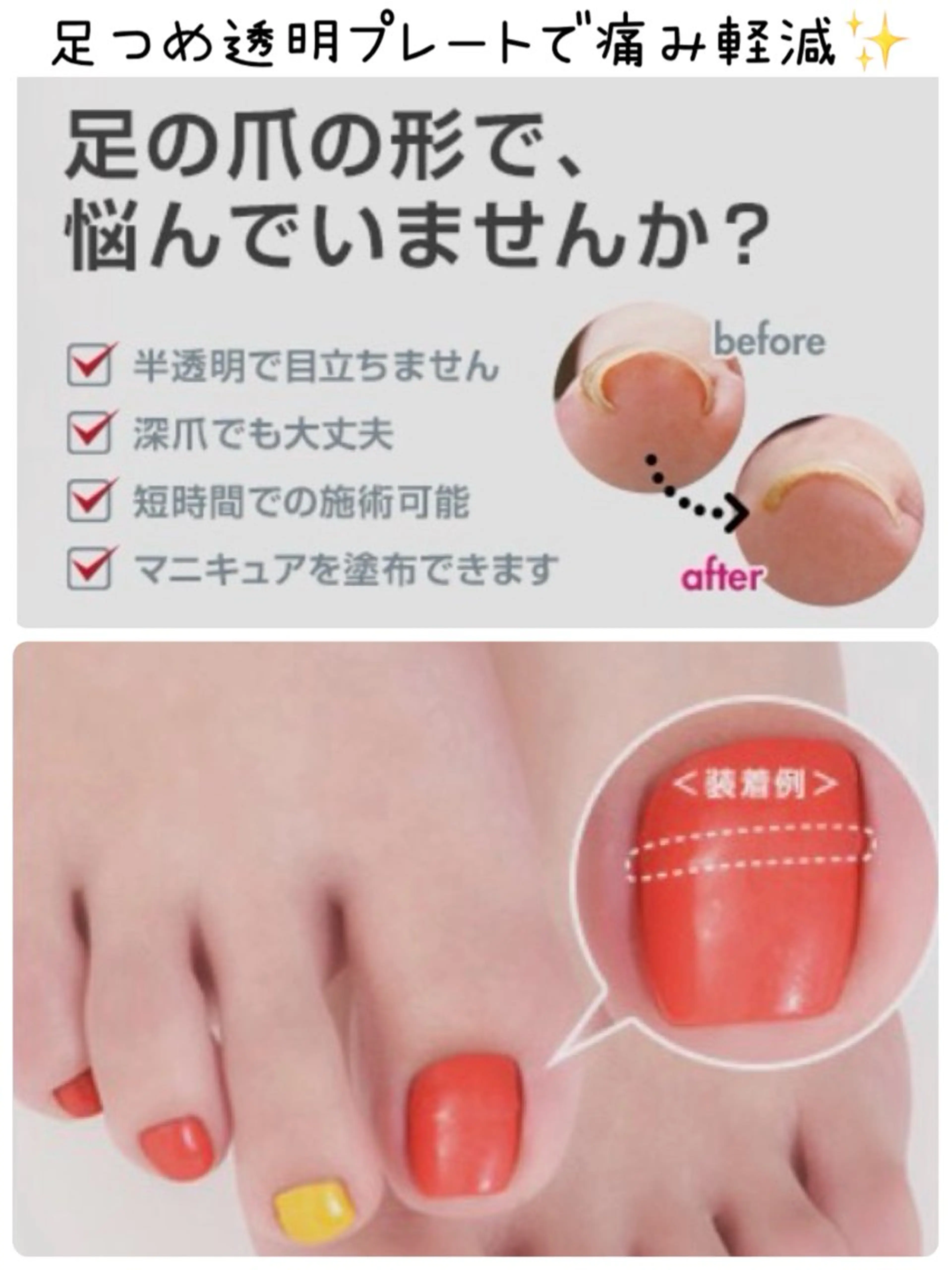 ネイル フットネイル Tairacchi ﾀｲﾗｯﾁのエステ・リラクイメージ