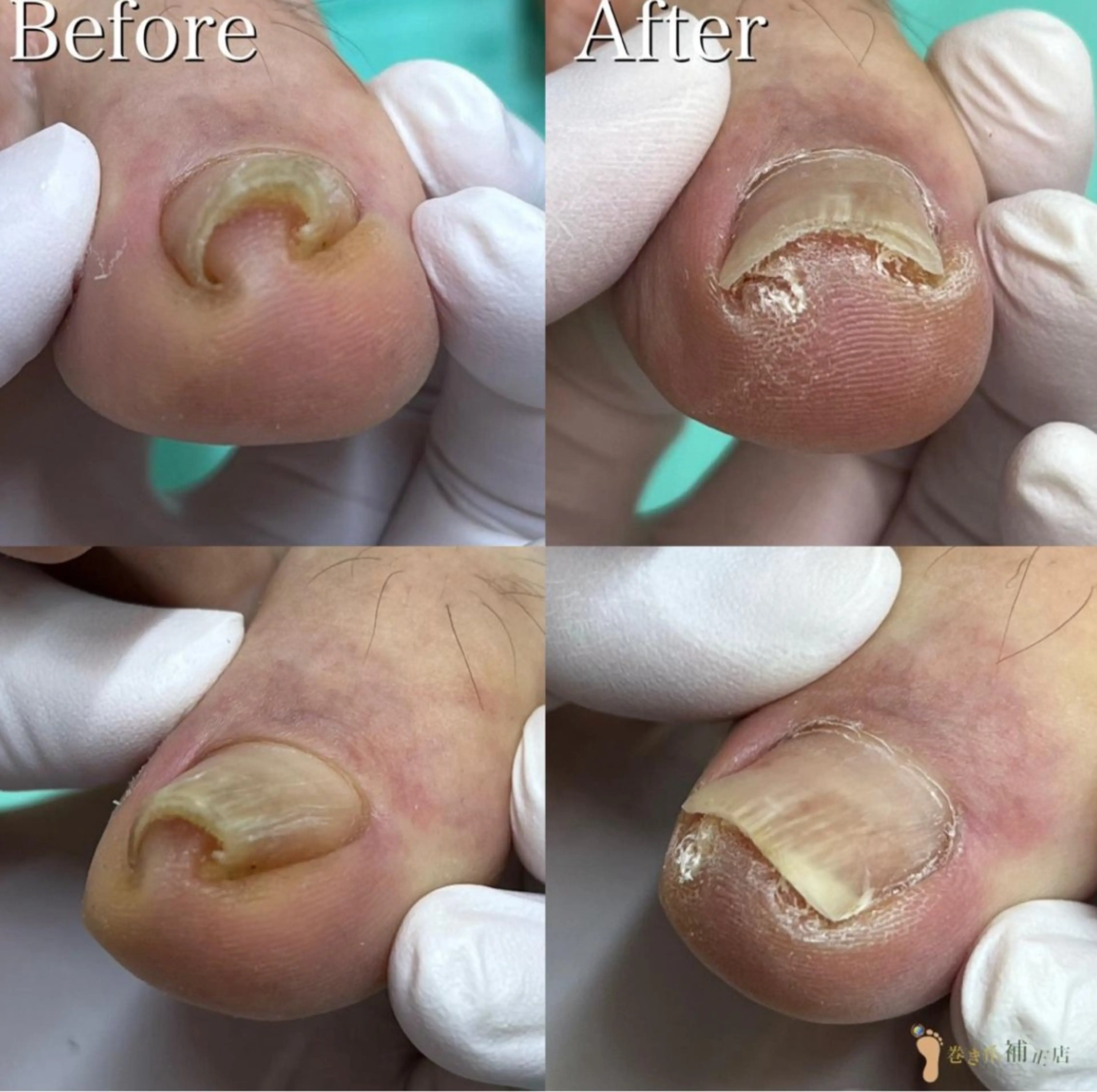 リラク 福岡巻き爪補正店 博多店のエステ・リラクイメージ