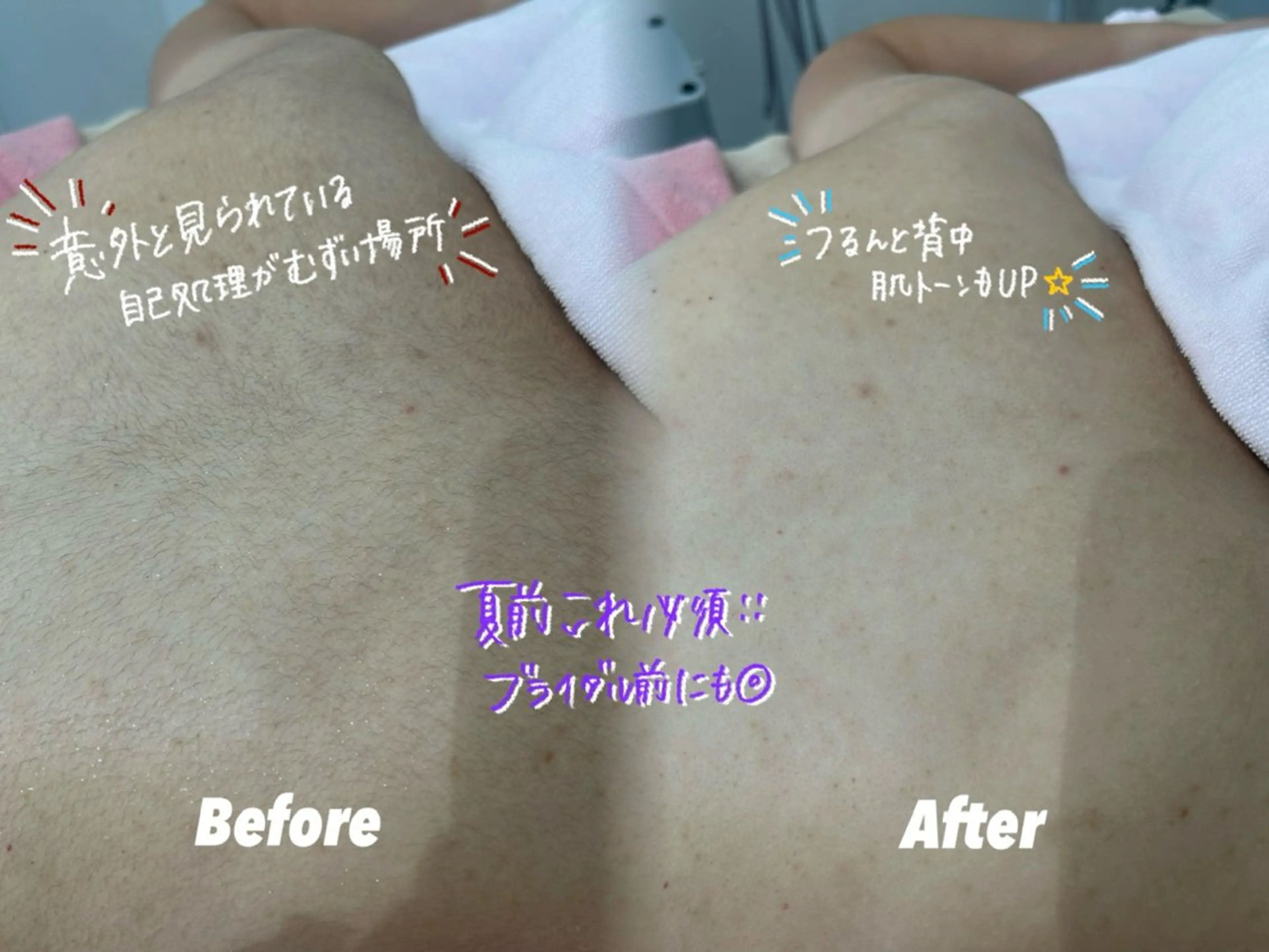 その他 🫧美しい素肌へ🫧 今成柚乃のその他イメージ