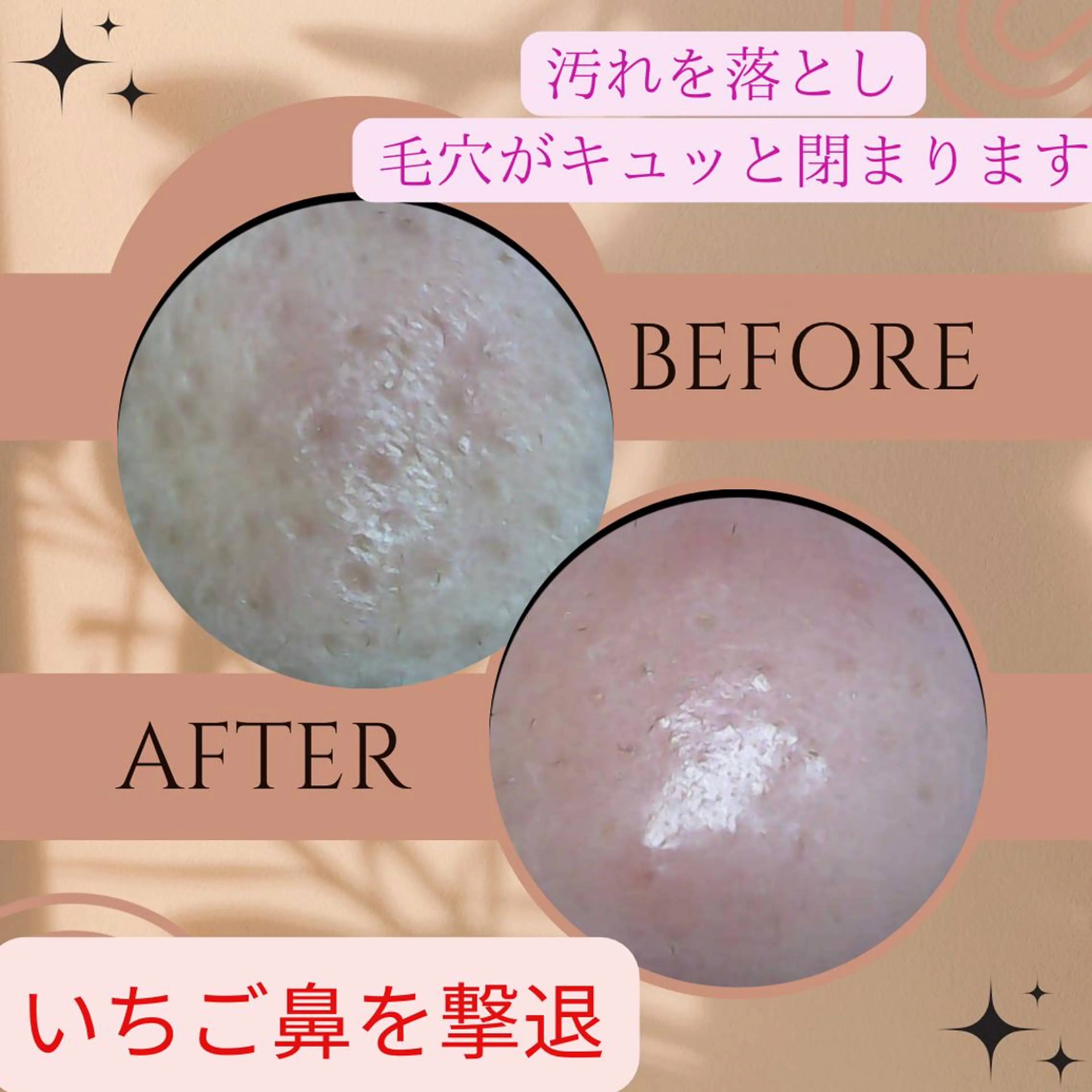 いちご鼻撃退！ツルツル鼻に！特許製法で作られたジェルを使用！メイクのノリも変わります！メンズもokの写真