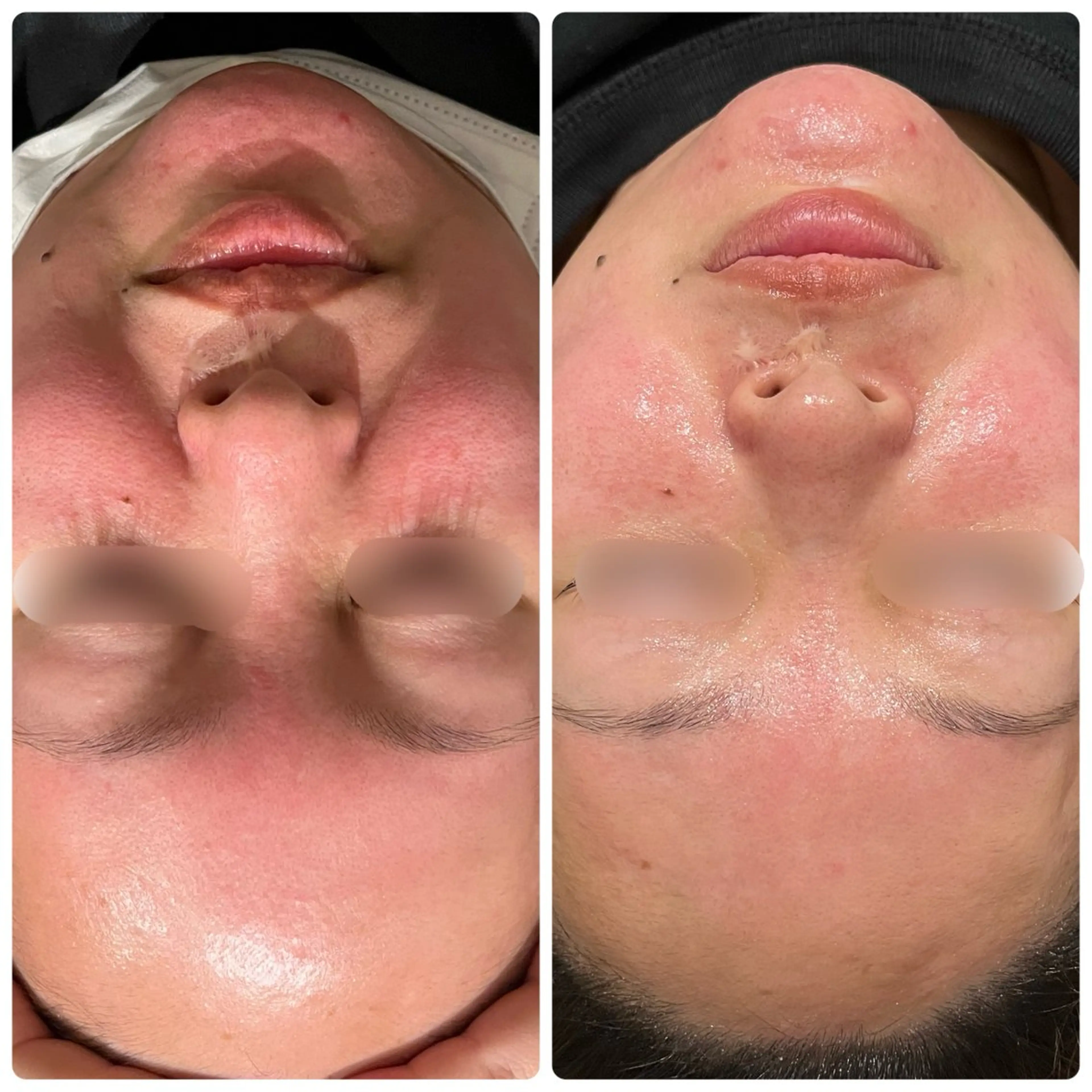 エステ Sena Dewi SAE🌼のその他イメージ