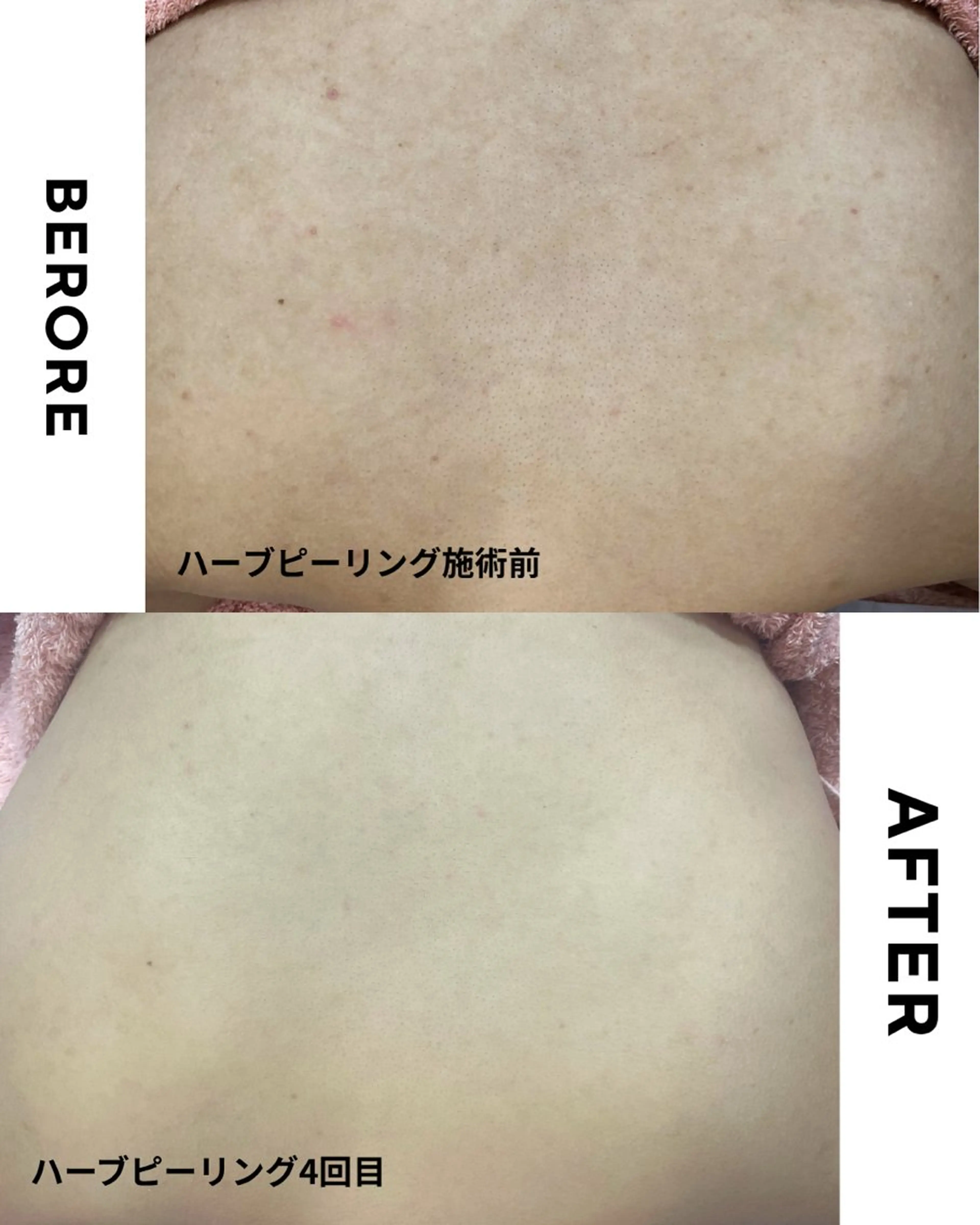 エステ 肌質改善専門サロン Bellmi/心斎橋のエステ・リラクイメージ