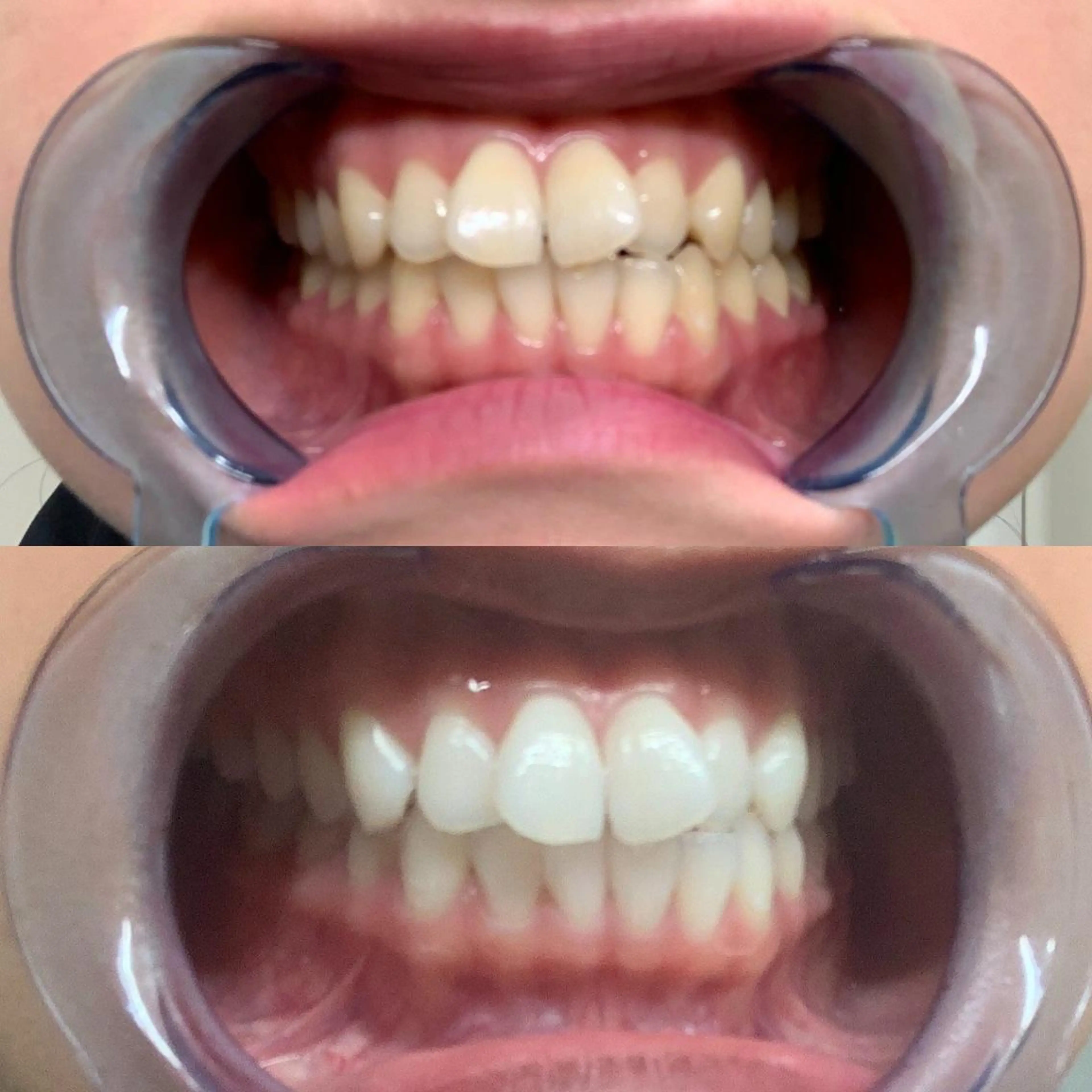 その他 ホワイトニング専門店 LCS 銀座店 峰岡のその他イメージ