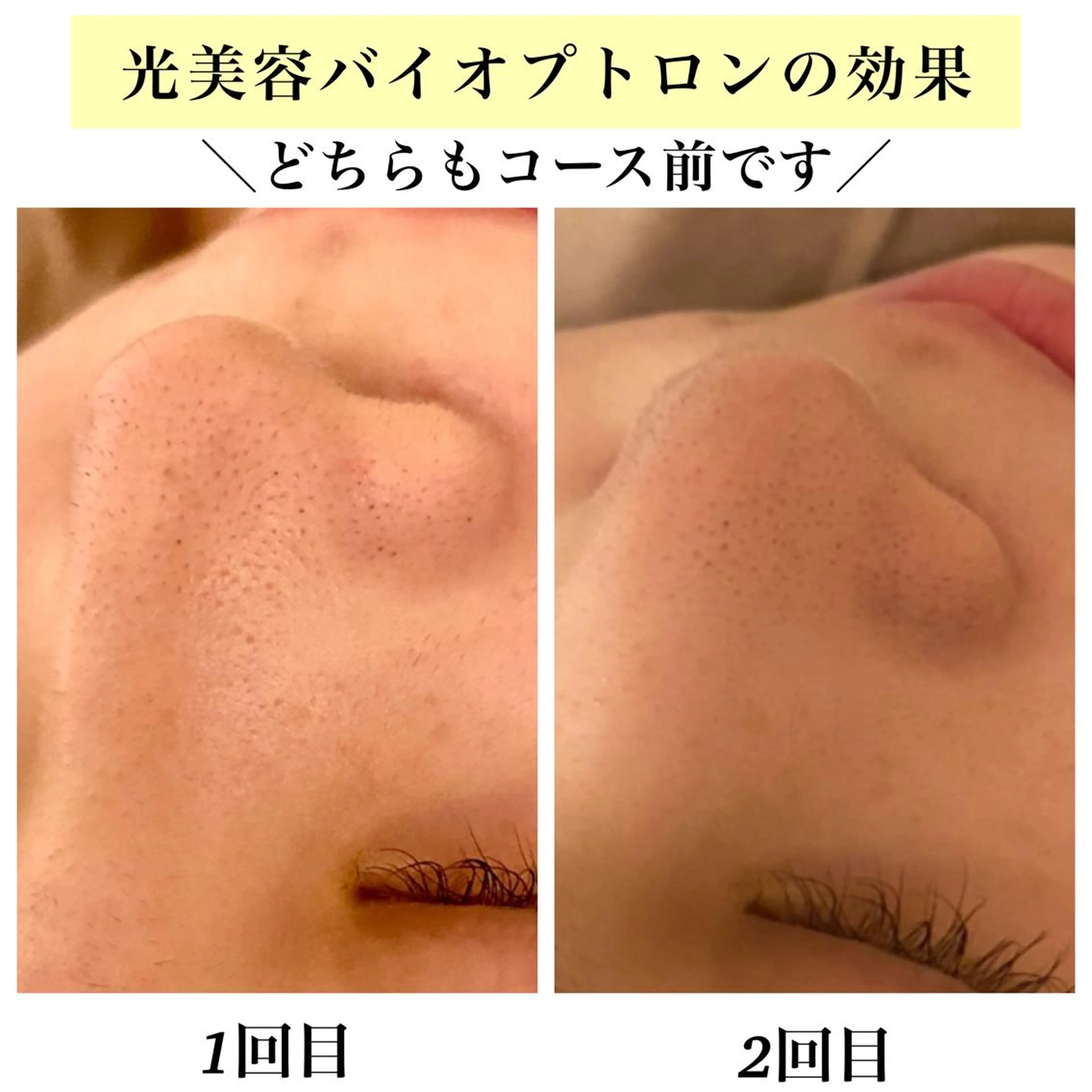 Bellesthe （ベルエステ）のエステ・リラクイメージ