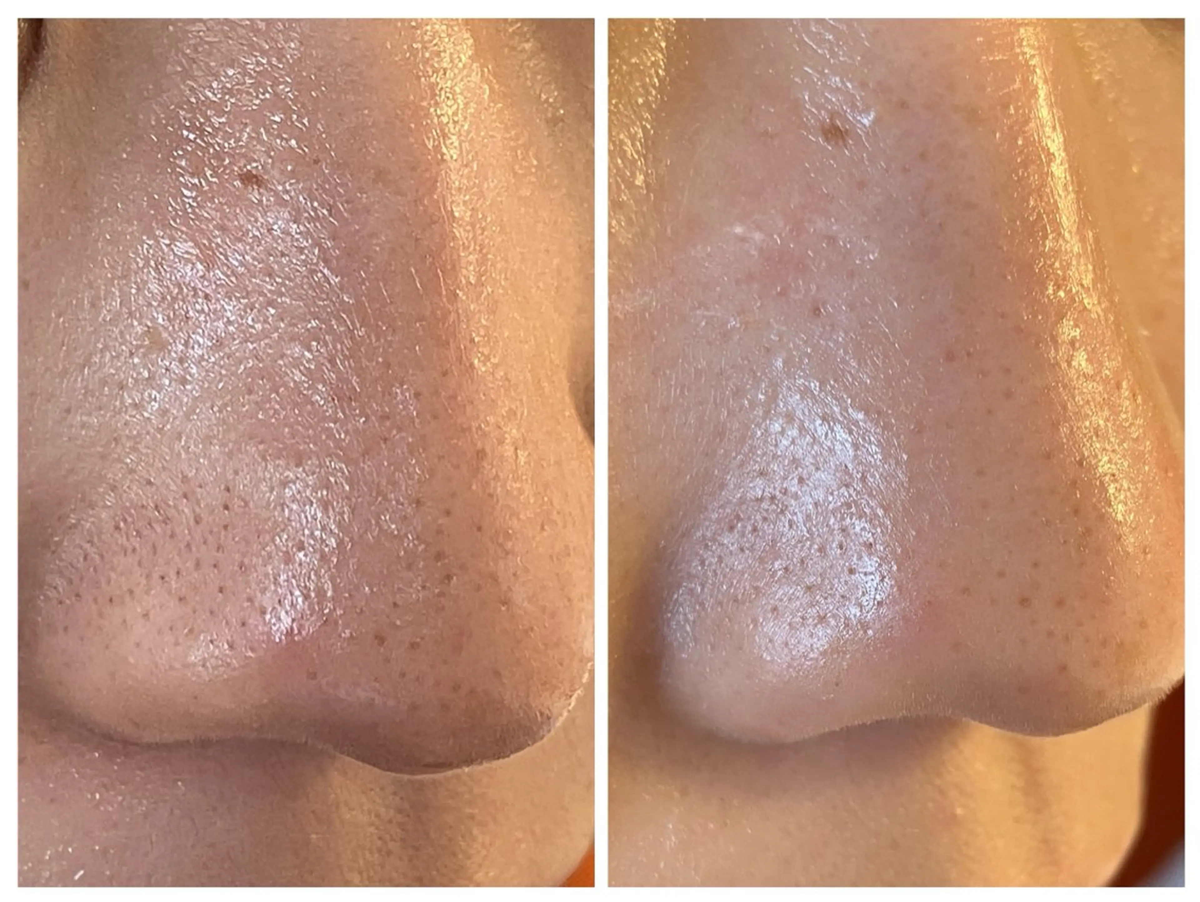 エステ 梅本 麿帆のエステ・リラクイメージ